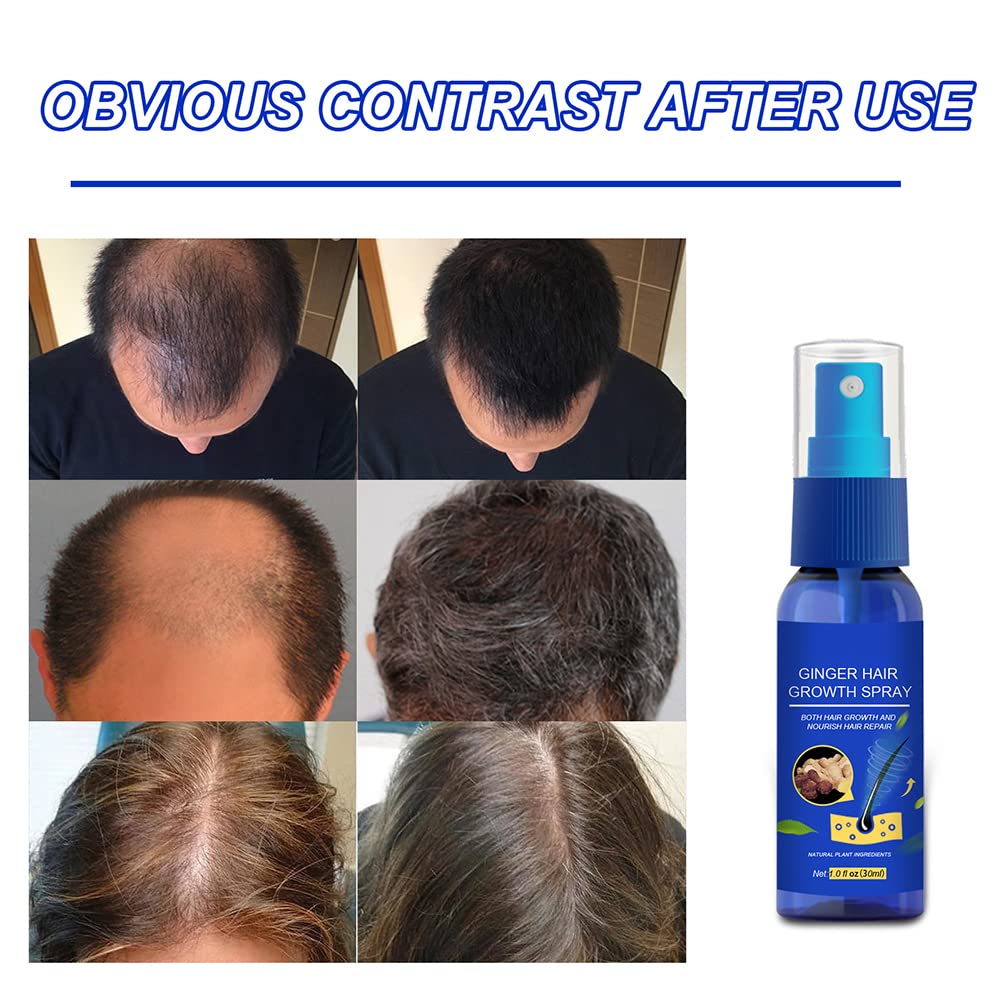 30ml Ginger Hair Regrowth Spray for Men & Women - Natural Hair Growth Serum with Ginger Extract for Thicker Hair & Fuller Beard - Anti Hair Loss Treatment to Strengthen Roots & Moisturize Scalp - Perfect for Daily Use at Home or Travel