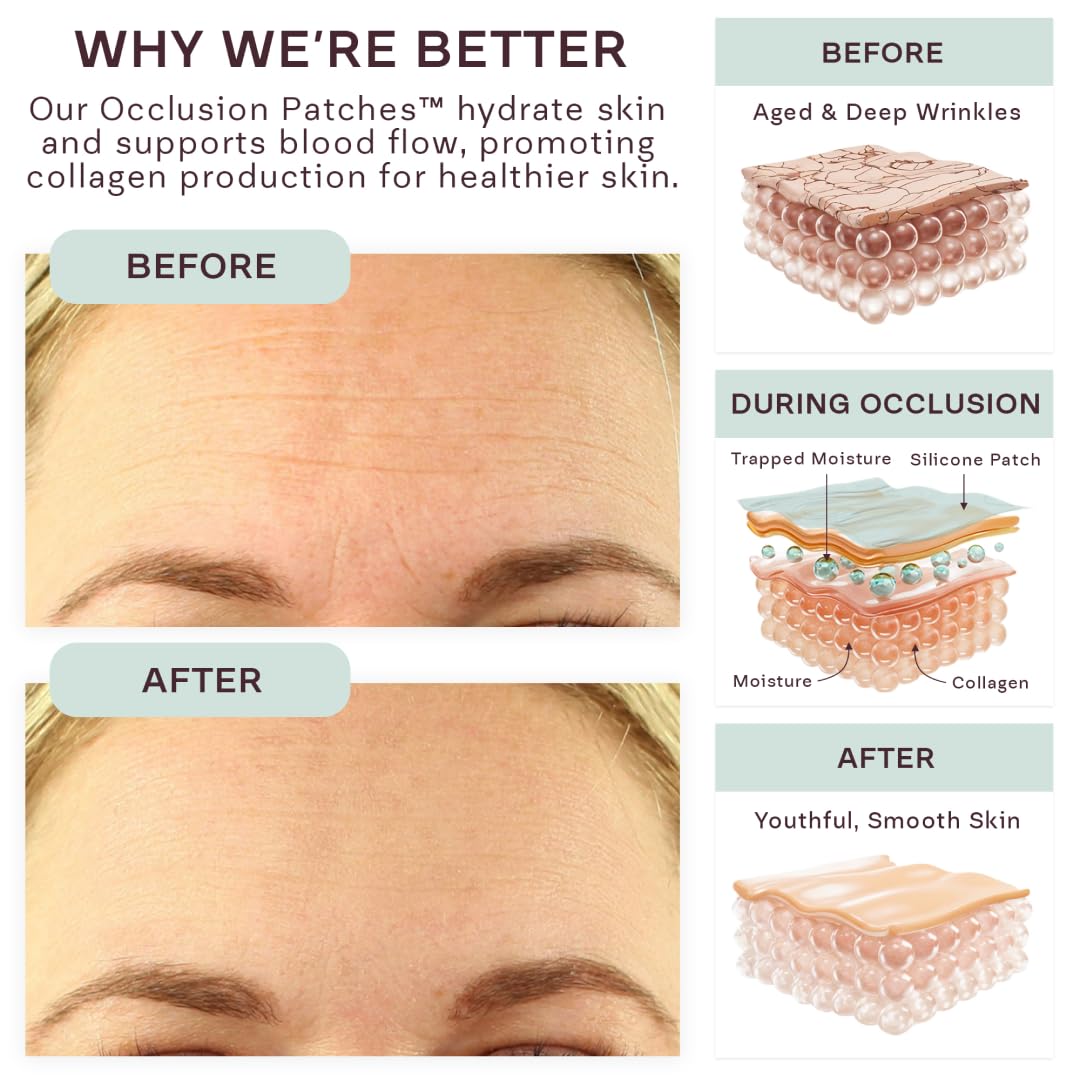 Dermaclara Anti-Wrinkle Silicone Face Patches Kit - Forehead, Smile Lines & Frown Line Treatment with Cleanser (30 Uses) - 1 Forehead, 2 Mouth, 2 Eye, 1 Neck Patches - Perfect for Overnight Wrinkle Reduction & Skin Smoothing
