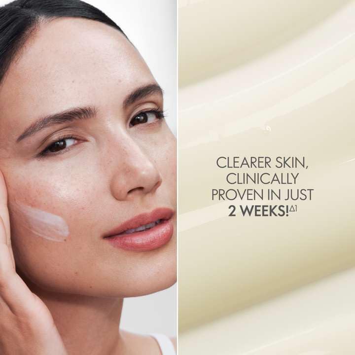 NOV AGE Blemish + Age Defy Routine Light-Skin Care Set - 5 Piece Anti-Aging Skincare Kit with Cleanser, Eye Cream, Serum, Day & Night Creams - Reduces Blemishes & Scarring for Youthful Glow - Perfect for Daily Skincare Routine & Anti-Aging Regimen