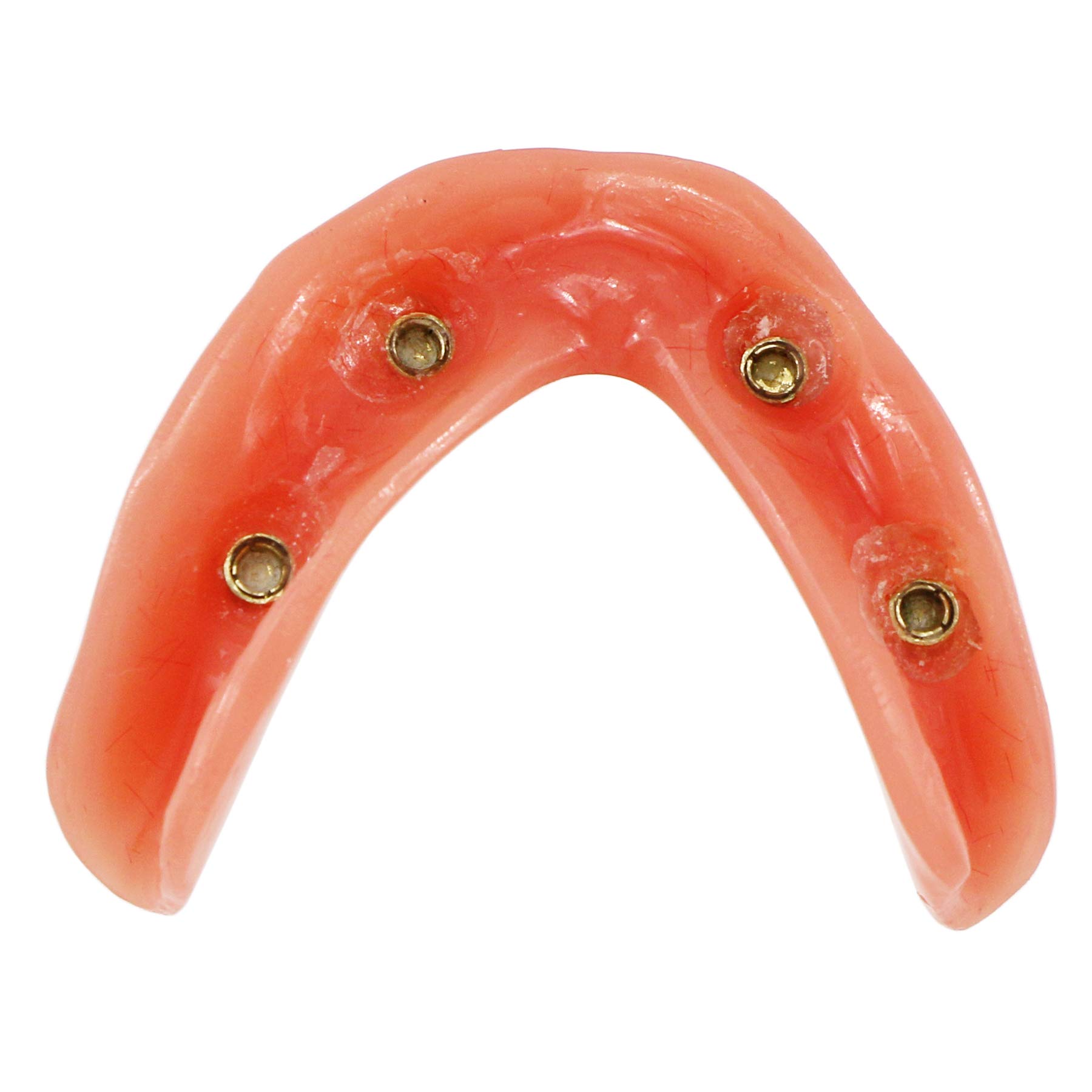 Dental Implant Teeth Model M6003 - Typodont Overdenture with 4 Implants for Lower Jaw Restoration | Dental Teaching & Study Demo | Perfect for Dental Students, Professionals & Clinical Practice