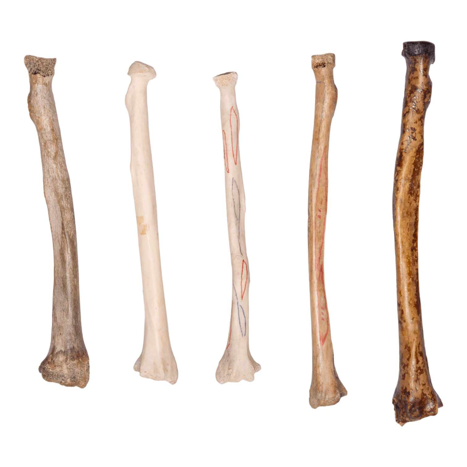 Vintage Human Radius Bone Specimen - Authentic Medical Collectible for Anatomy Study, Classroom Display & Gothic Decor