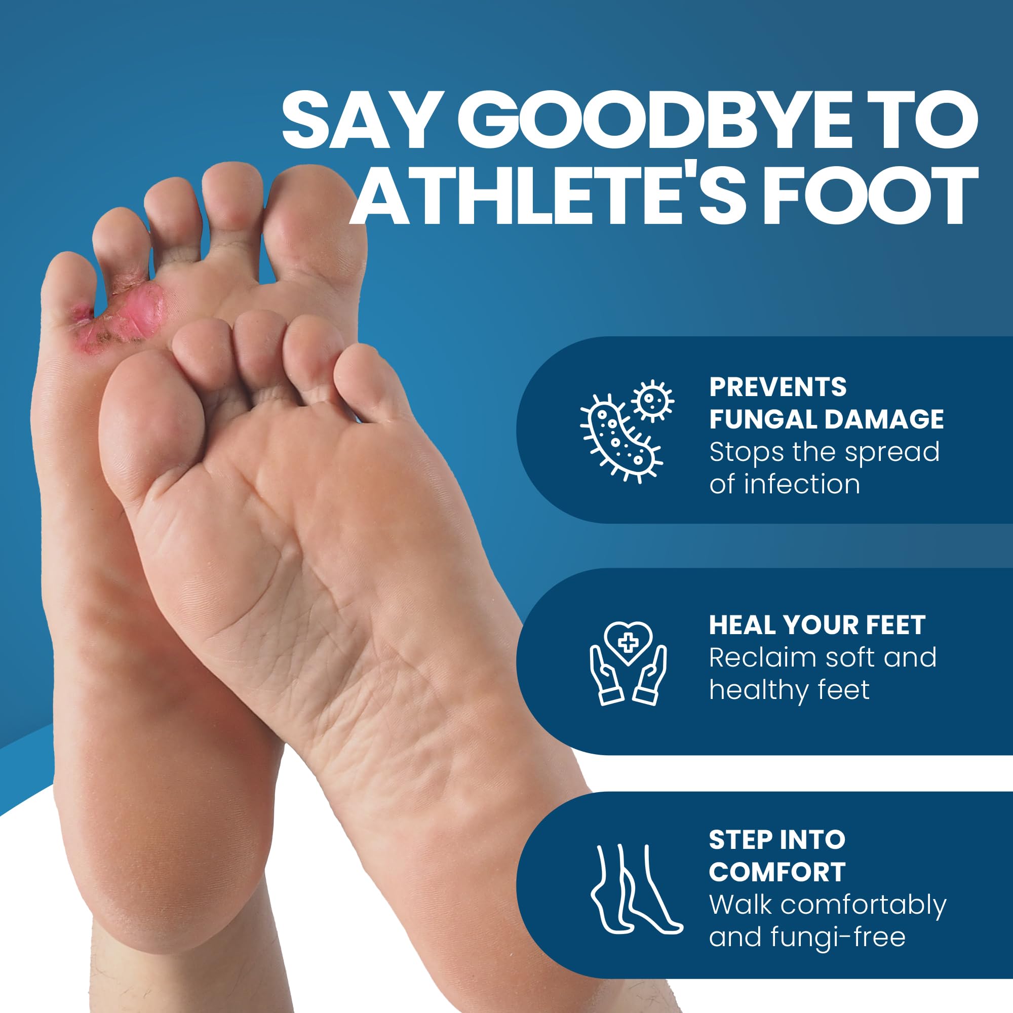 FUNGINIX AF Athlete's Foot Cream - Topical Anti-Fungal Treatment for Toe Fungus & Ringworm, Fast Relief for Itching & Burning, Doctor Recommended (3 Tubes) - Ideal for Gym, Pool & Locker Room Protection