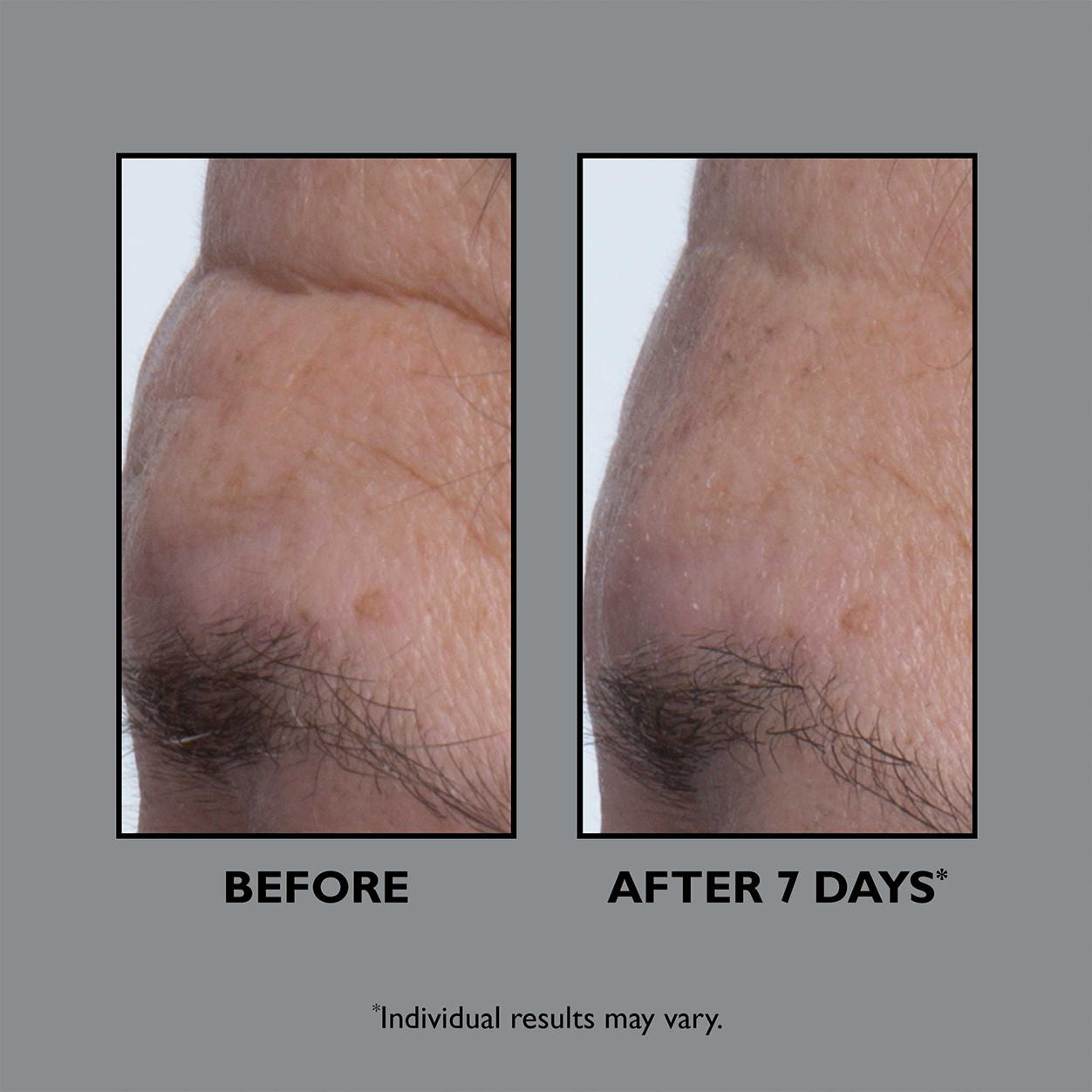 FIRMx Collagen Serum for Face - Anti-Aging & Wrinkle Reduction Treatment - Hydrating & Firming Skincare for Women & Men - Perfect for Night Routine & Daily Moisturizing