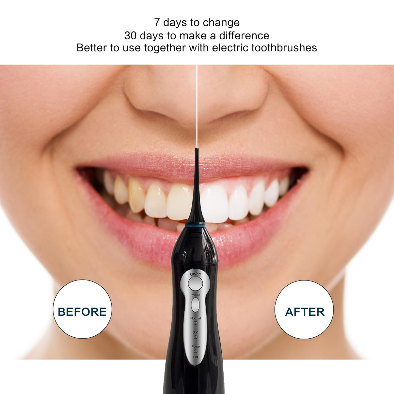 TOVENDOR Cordless Water Dental Flosser - 300ML Rechargeable Oral Irrigator with 5 Nozzle Tips | IPX7 Waterproof Teeth Cleaner for Braces, Gums & Deep Cleaning | Perfect for Travel & Home Use
