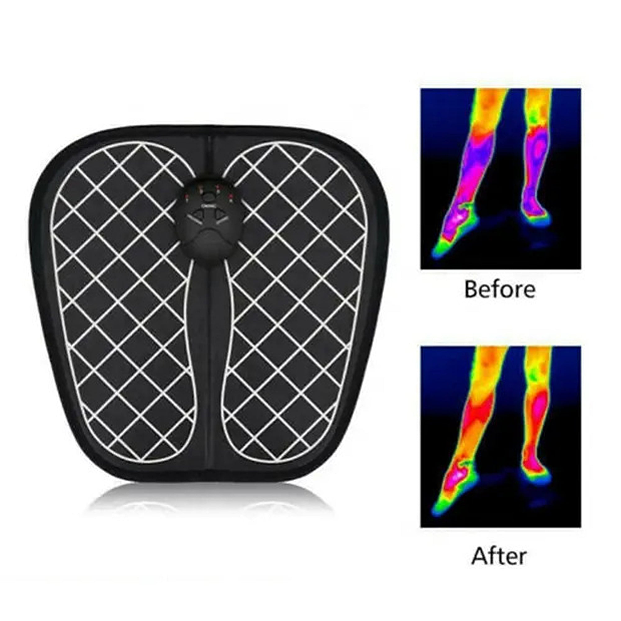 THERMOSAGE EMS 8-in-1 Total Leg Massager for Pain Relief & Muscle Recovery - Electric Stimulation Therapy for Athletes, Runners & Home Use