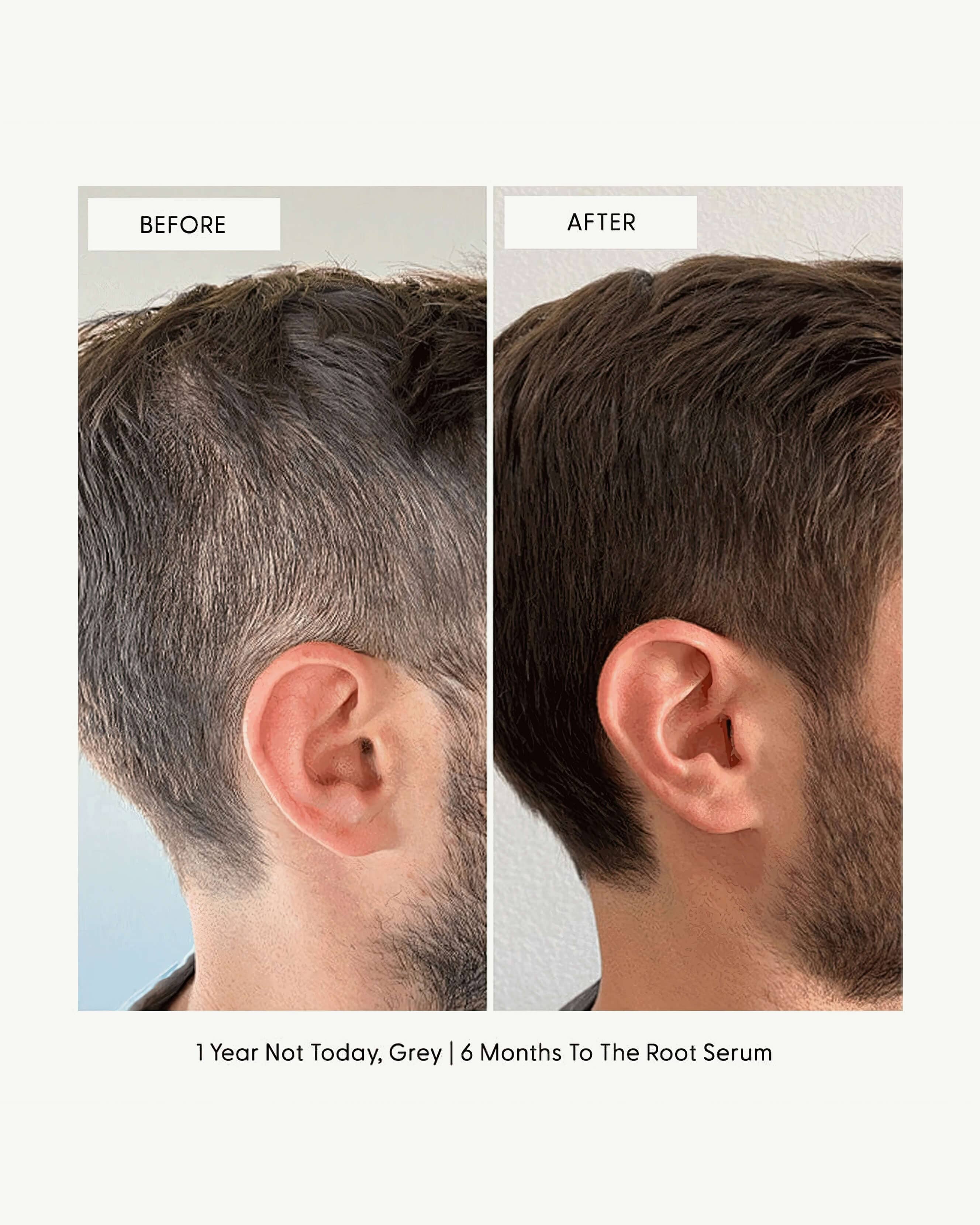 To The Root Hair Growth Serum - Natural & Organic Scalp Treatment for Thicker, Stronger Hair - Perfect for Daily Use at Home or Salon