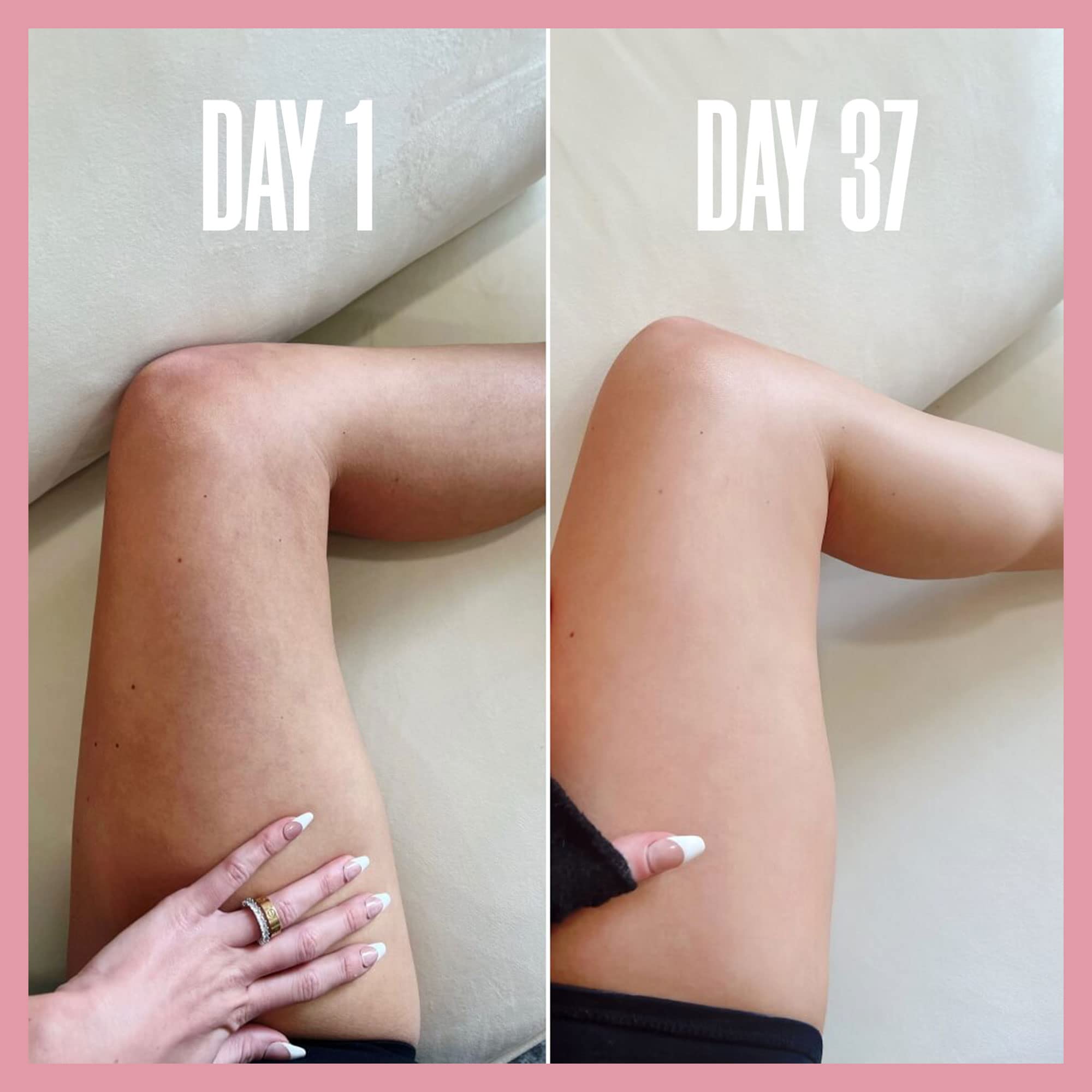 MAËLYS Premium Body Smoothing Bundle – Firming & Toning Cream Set for Cellulite Reduction & Stretch Marks – Perfect for Post-Pregnancy, Weight Loss & Daily Skincare Routine
