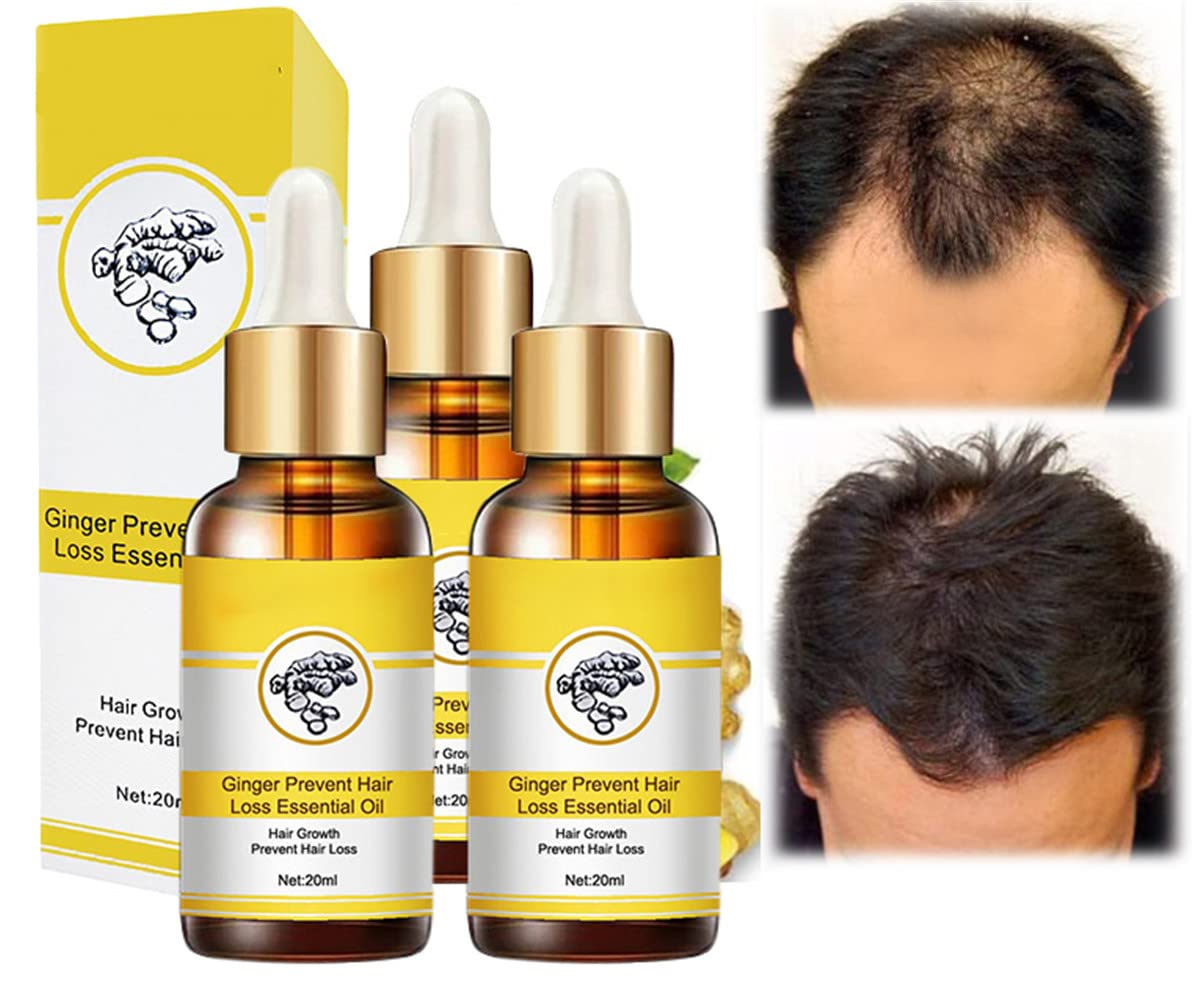 KDGENG Ginger Hair Growth Oil - Natural Hair Growth Serum with Ginger Germinal Oil for Thinning Hair & Anti Hair Loss | Hair Thickness Maximizer & Essential Oil Treatment (3 Pack) - Perfect for Daily Scalp Massage & Hair Care Routine