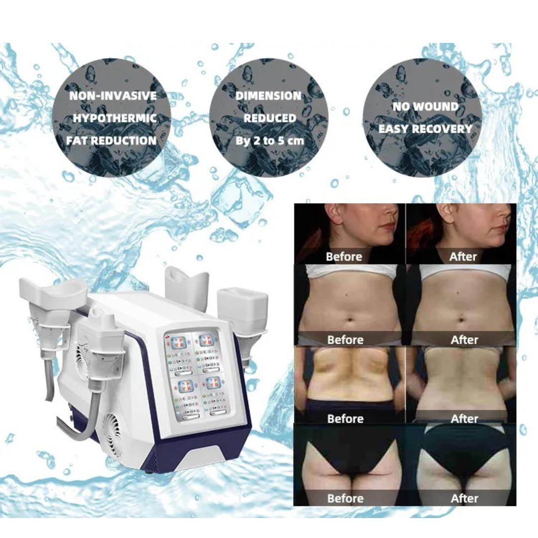 Portable Cryotherapy Machine with 6 Medical Grade Applicators - Professional Cold Therapy for Pain Relief, Muscle Recovery & Skin Treatment - Perfect for Home, Gym & Sports Therapy