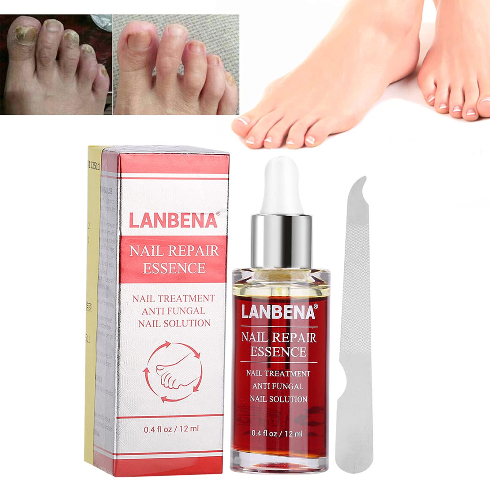 12ML Natural Nail Repair Essence - Powerful Anti-Fungus Treatment for Damaged & Discolored Nails | Effective Nail Care Solution for Toenails & Fingernails | Perfect for Salon Use & Home Manicures