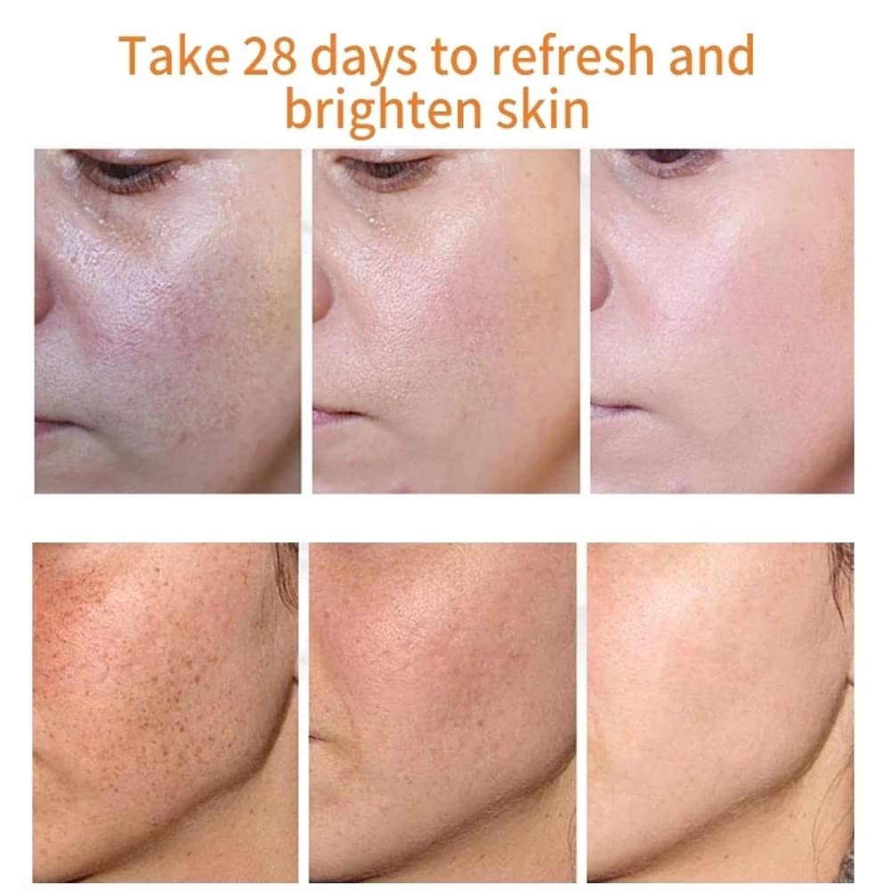 LUCKKY 2PCS Whitening Freckle Cream - Dark Spot Corrector, Scar & Pigmentation Treatment for Face with Moisturizing Formula | Brightens Skin, Reduces Blemishes & Freckles | Perfect for Daily Skincare Routine & Nighttime Treatment