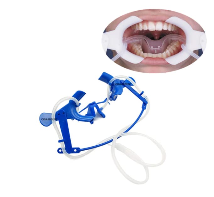 **Autoclavable Dental Mouth Opener & Cheek Retractor - Disposable Lip Retractor for Teeth Whitening & Orthodontic Procedures (Blue) | Ideal for Dental Clinics, Oral Surgery & Mouthguard Fitting**