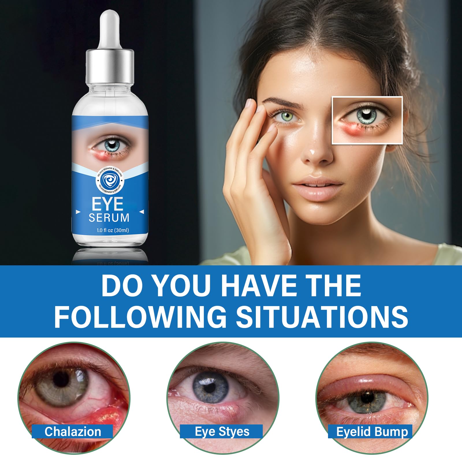 Effective Eye Serum for Chalazion & Blepharitis Treatment - Gentle Lash & Eye Cleanser (30mL) - Soothes Irritation & Promotes Healing for Daily Eye Care Routine