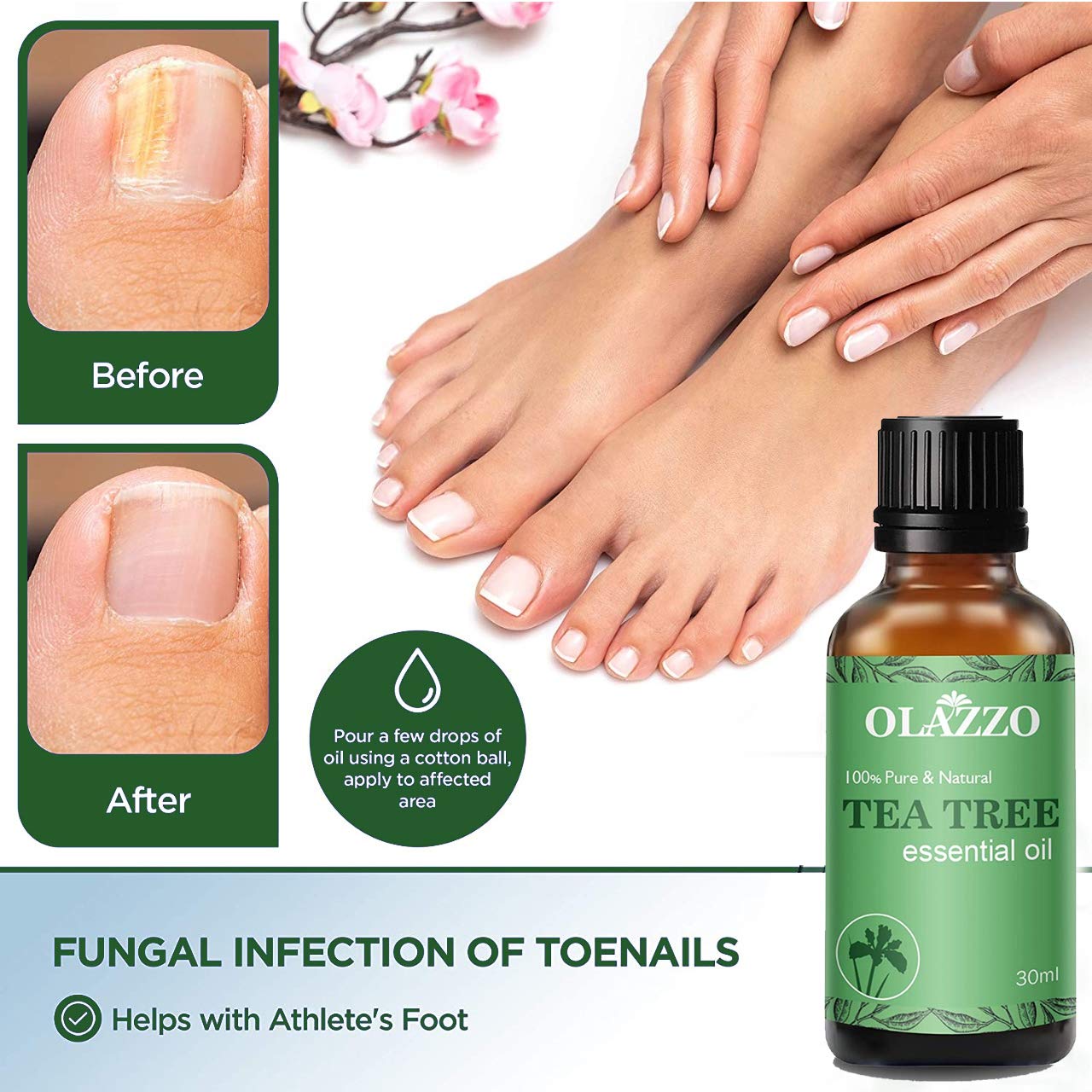 Pure Tea Tree Essential Oil for Skin, Hair & Face - 100% Natural Steam Distilled Treatment for Acne, Dandruff & Healthy Nails | 30ml Organic Oil for Aromatherapy, DIY Beauty & Home Remedies