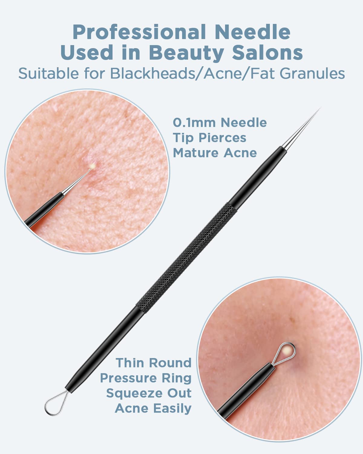 Professional Stainless Steel Blackhead Remover & Pimple Popper Kit - Acne Extractor Tool for Face, Comedones, Whitehead & Blemish Removal - Perfect for Home Skincare & Spa Treatments