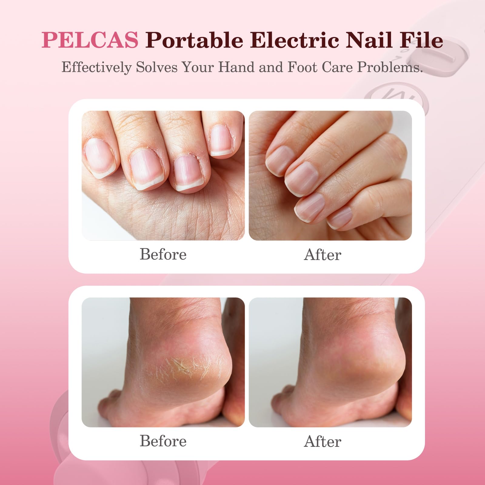 PELCAS Professional Cordless Electric Nail File Kit - 10-Speed LED Nail Drill with LCD Screen for Manicure & Pedicure | Safe for Natural, Acrylic Nails & Thick Toenails | Perfect for Home Salon, Pet Grooming & DIY Nail Care