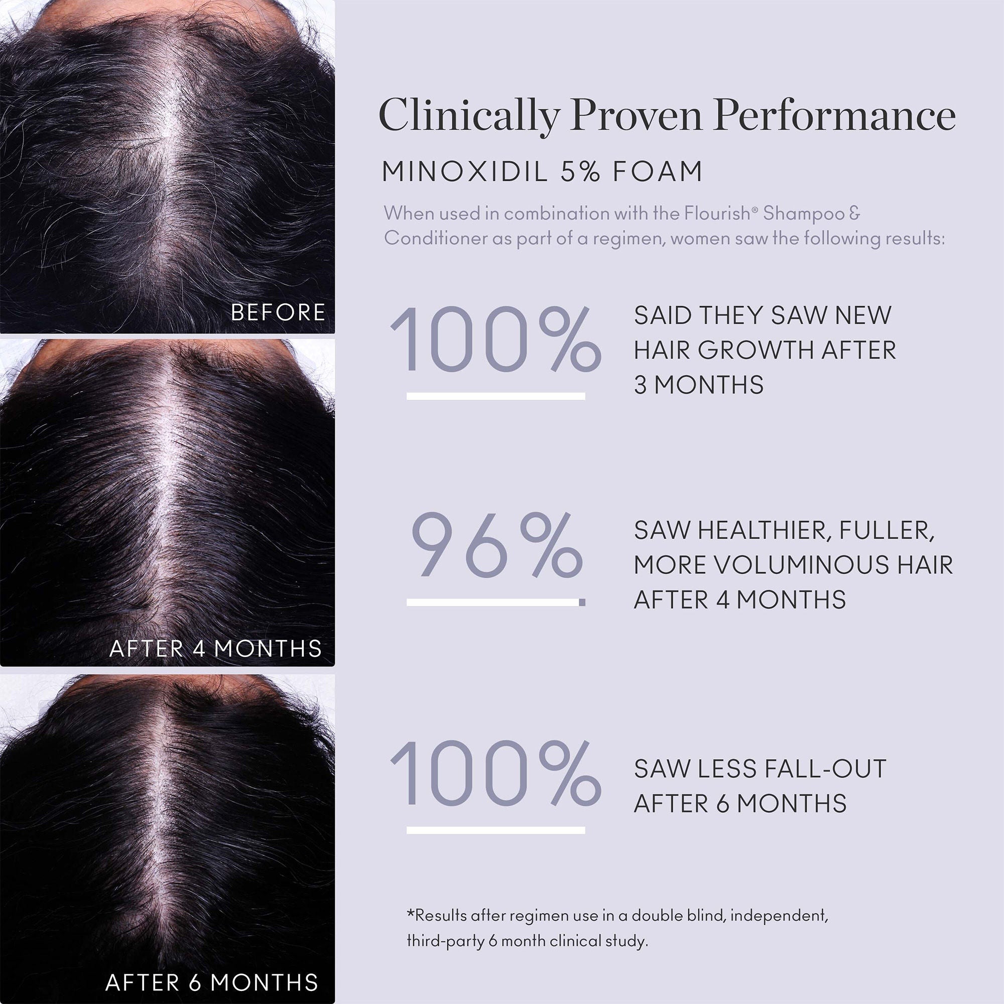Flourish Minoxidil Foam for Hair Growth Treatment - 5% Minoxidil Foam for Men & Women - Hair Regrowth Solution for Thinning Hair - Single Canister (3-Month Supply) - Perfect for Daily Use at Home or Travel