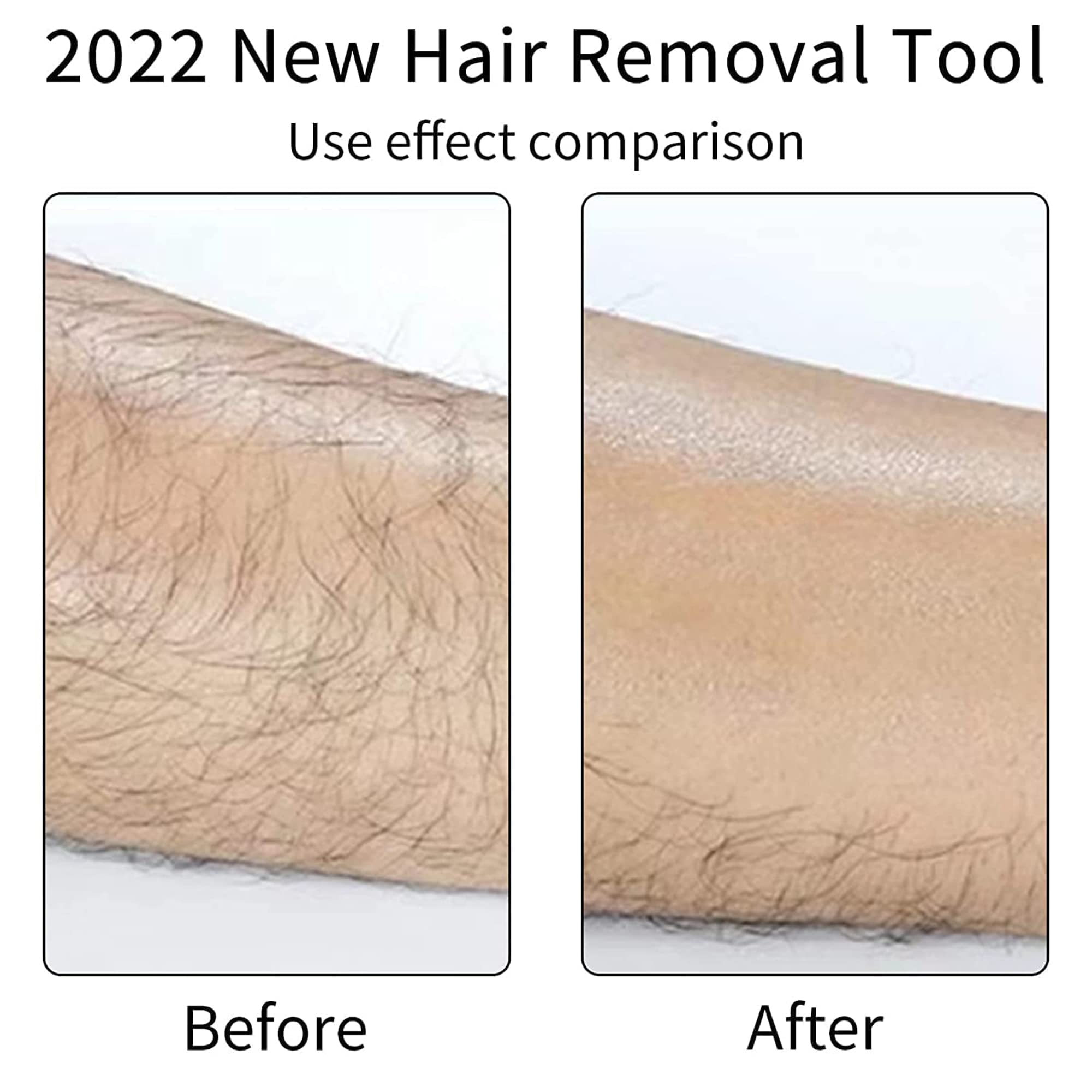 Shomex® Nano-Crystalline Hair Remover for Women & Men - Crystal Hair Eraser with Advanced Technology | Painless Hair Removal for Face, Legs, Arms & Bikini Area at Home