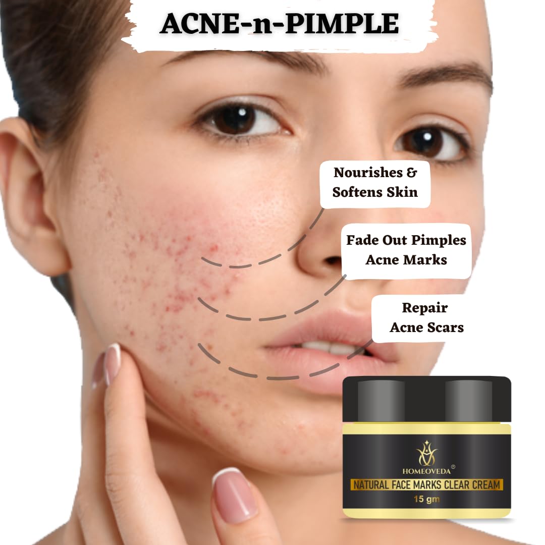 Homeoveda Natural Face Marks Clear Cream - Reduces Acne, Pimples, Blemishes, Pigmentation & Stretch Marks | 15gm | Organic Skincare Solution for Clear, Healthy Skin | Perfect for Daily Use & Post-Acne Care