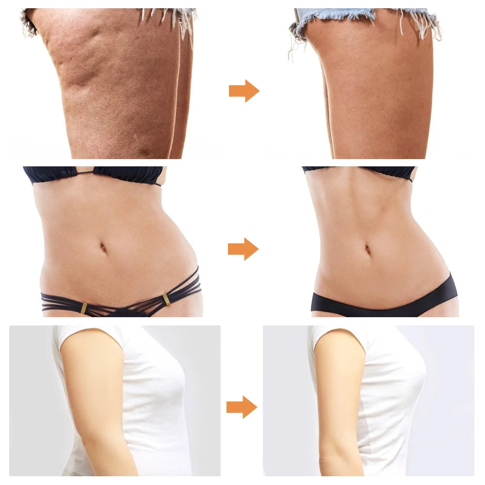 Professional Fat Burner Machine for Belly, Arm & Leg - Portable Body Liposuction Device for Weight Loss & Toning | Home Gym & Spa Use