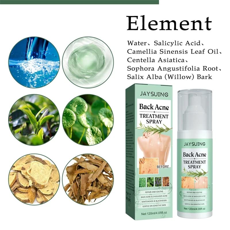 2% Salicylic Acid Back Acne Spray Treatment with Tea Tree Oil & Herbal Formula - 4.05 oz Acne Solution for Teens & Adults | Clear Body Breakouts for Gym, Sports & Daily Use