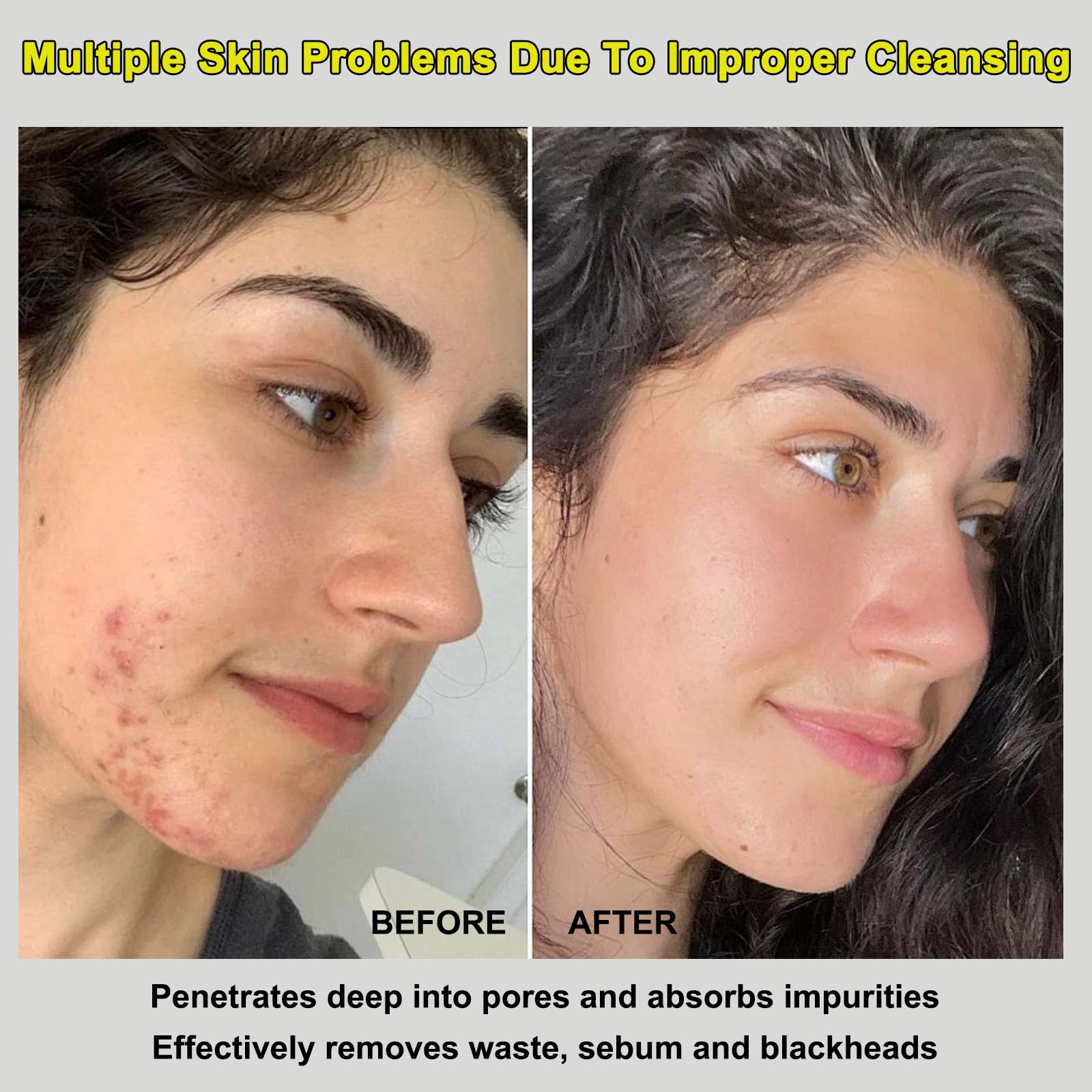 Recovery Mud Mask for Face & Body - Deep Cleansing & Hydrating Clay Mask with Oil Control | Pore Minimizer & Skin Detoxifier | Perfect for Spa Days & Post-Workout Skin Recovery