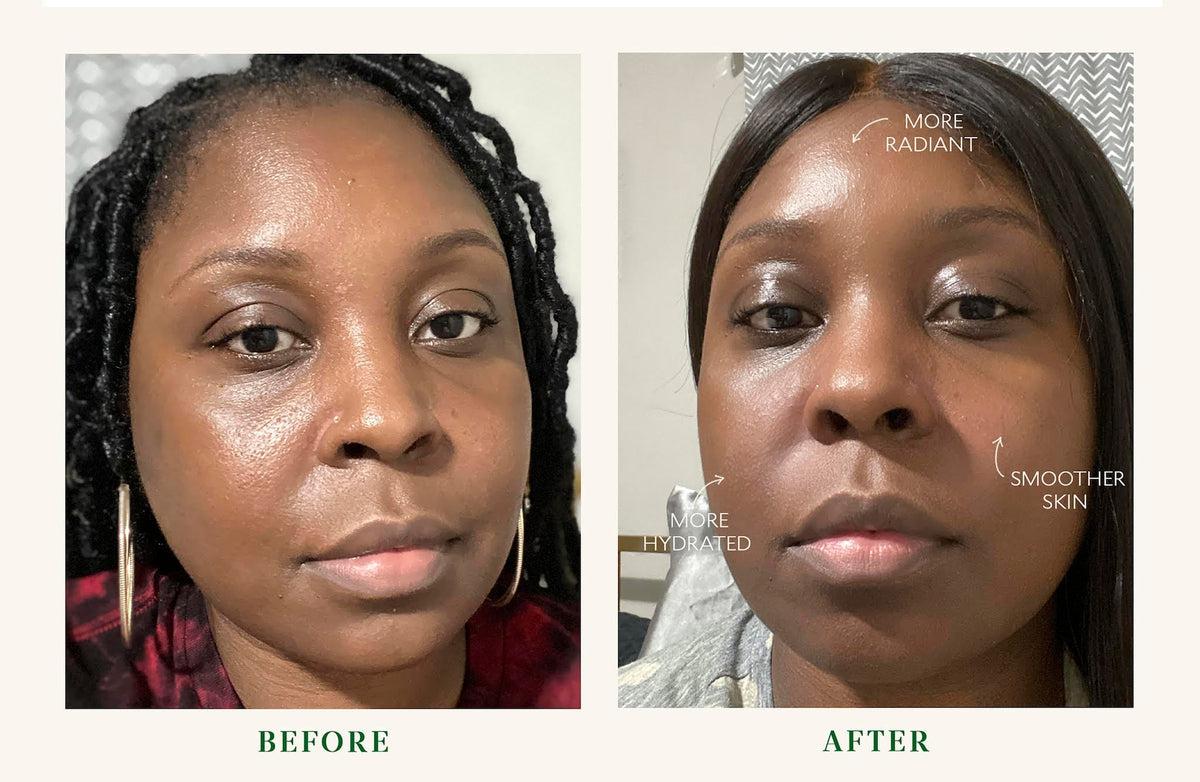 Bio Barrier Eye Cream - Anti-Aging & Hydrating Under Eye Treatment for Dark Circles & Wrinkles | Perfect for Night Routine & Travel Skincare