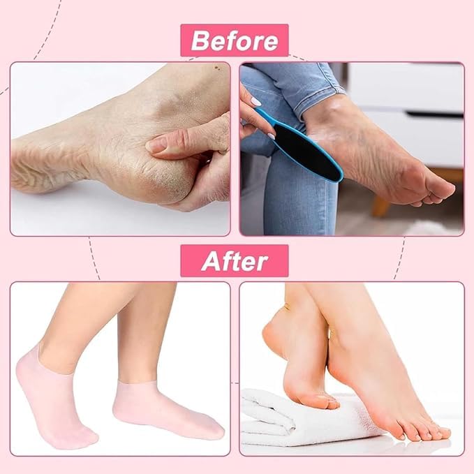 DS CARE Moisturizing Silicone Gel Socks for Dry Cracked Feet - Heel Repair & Foot Moisturizer Socks with Natural Oil & Vitamin E - Spa Treatment for Women & Men (Multicolor, 1 Pair) - Perfect for Overnight Foot Care & Cracked Heel Recovery