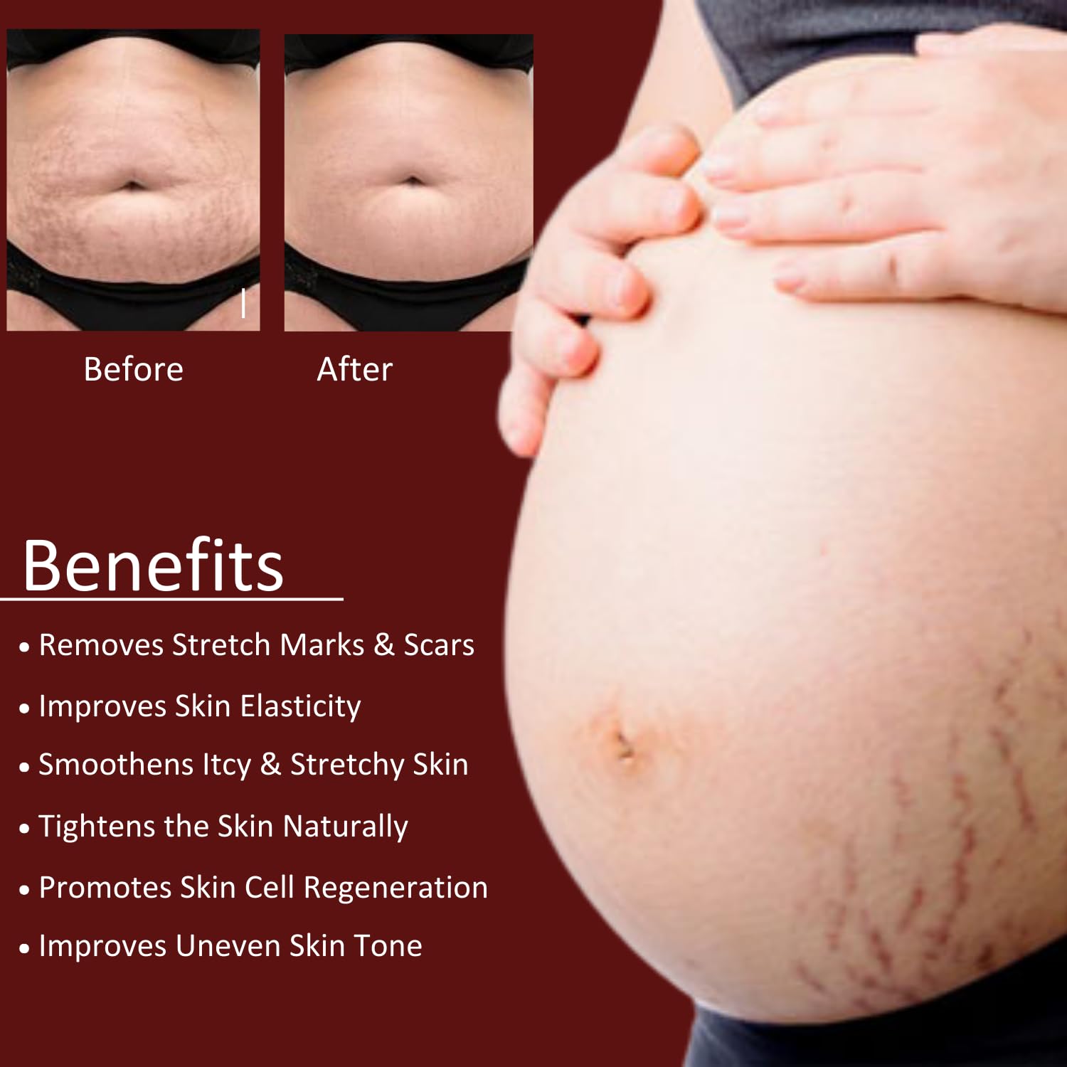 INTIMIFY Stretch Marks Oil & Cream for Women - Pregnancy Safe, 30ml - Hydrating & Nourishing for Belly, Hips & Thighs - Perfect for Pre & Postpartum Care & Daily Skin Moisturizing