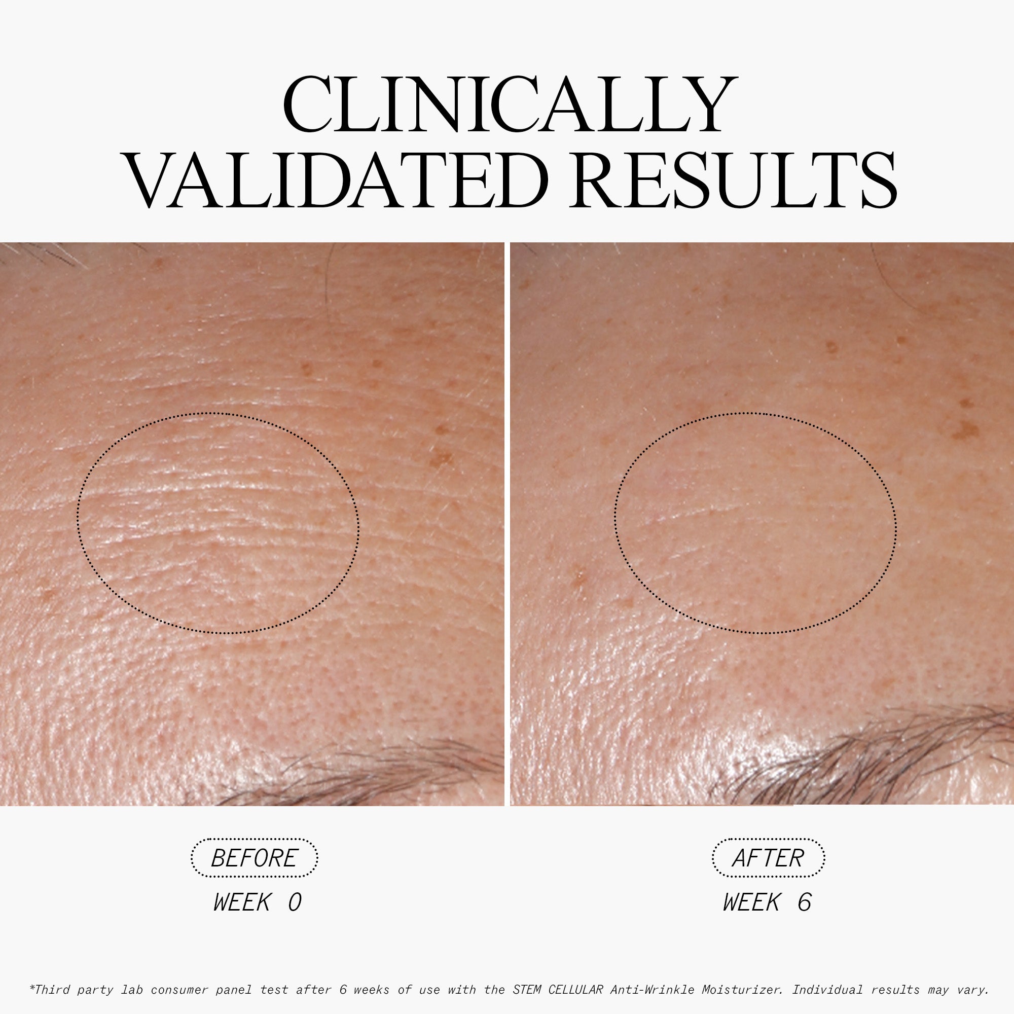 Best Anti-Wrinkle Moisturizer Cream for Face - Hydrating & Firming Skincare Treatment - Day & Night Use for Women & Men