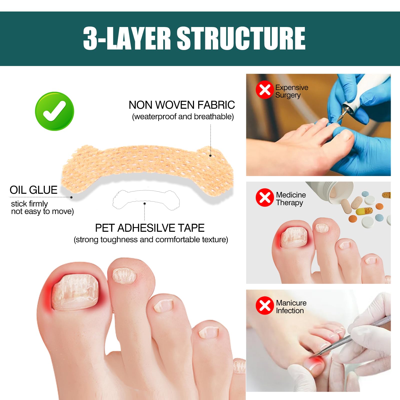 Professional Ingrown Toenail Treatment Strips & Pedicure Kit - 140 Pcs for Pain Relief & Toenail Care | Perfect for Home Use, Salon Treatments & Post-Surgery Recovery