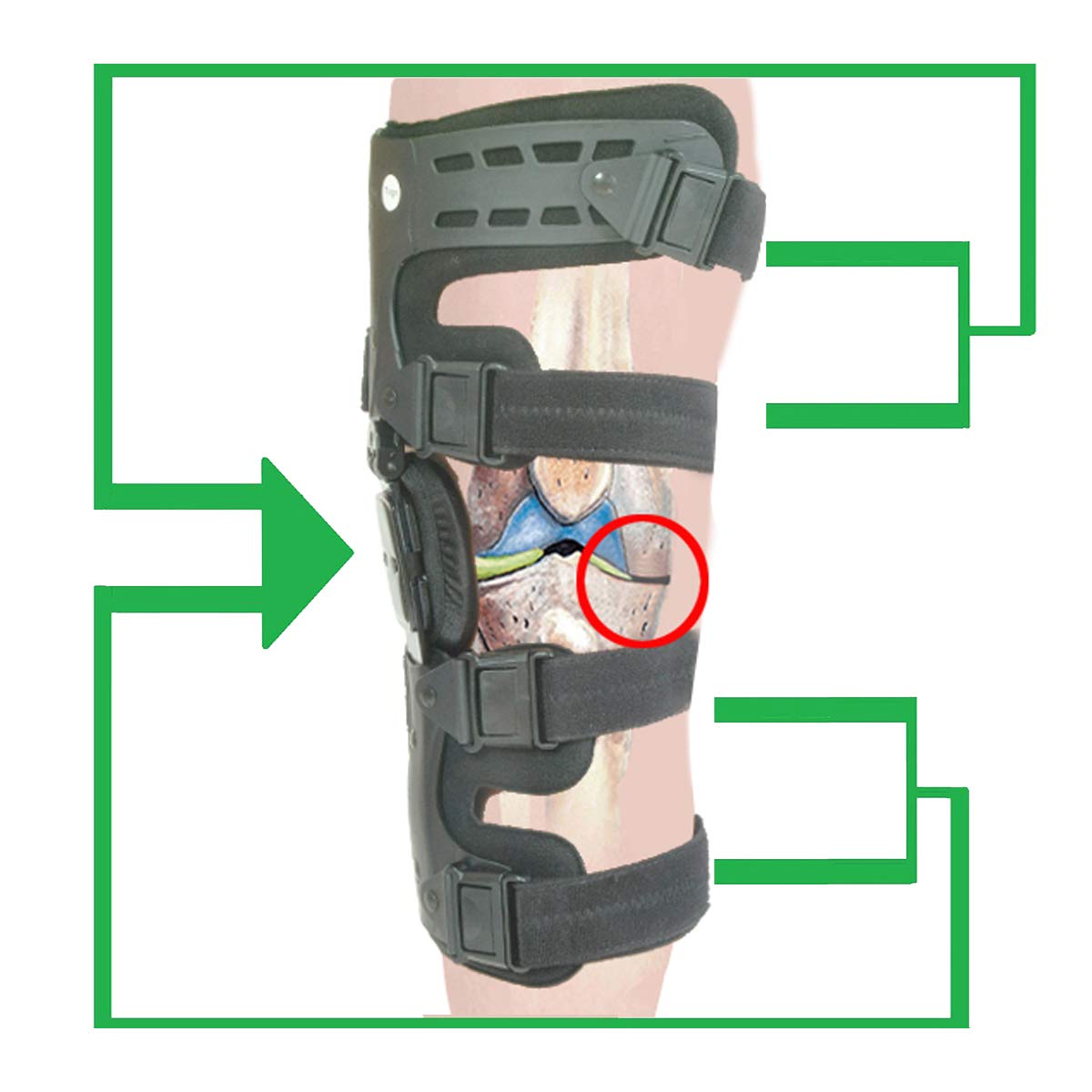 Orthomen Lateral Unloader Knee Brace for Osteoarthritis & Bone-on-Bone Pain Relief - Adjustable Support for Left Knee with Built-in Hex Key (Models L1851 & L1843) - Ideal for Running, Hiking & Daily Activities