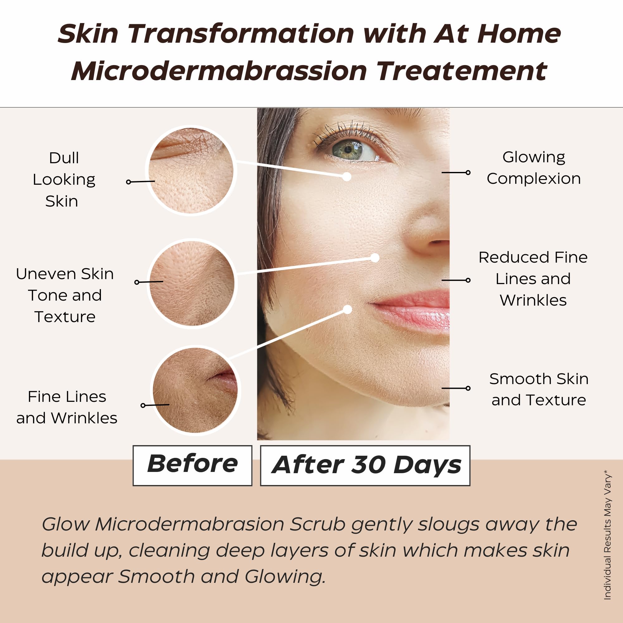 Glow Microdermabrasion Polish - Anti-Aging Face Scrub with Natural Vitamin C, Salicylic Acid & AHAs | Deep Exfoliation for Dull, Dry Skin | Reduces Pores & Wrinkles | Achieve Radiant, Smooth Skin | Perfect for Daily Skincare Routine & Spa-Like Glow at Home