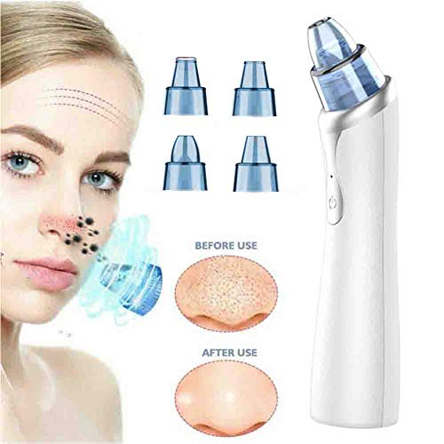 Electric Blackhead Remover Vacuum - Facial Pore Cleaner for Women & Men | Acne Treatment & Skin Care