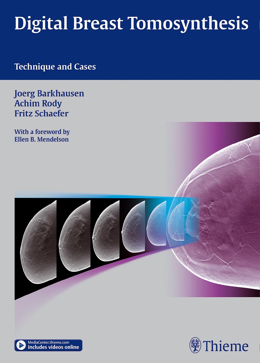 Digital Breast Tomosynthesis (DBT) Technology: Techniques, Case Studies & Applications for Breast Cancer Screening and Diagnosis