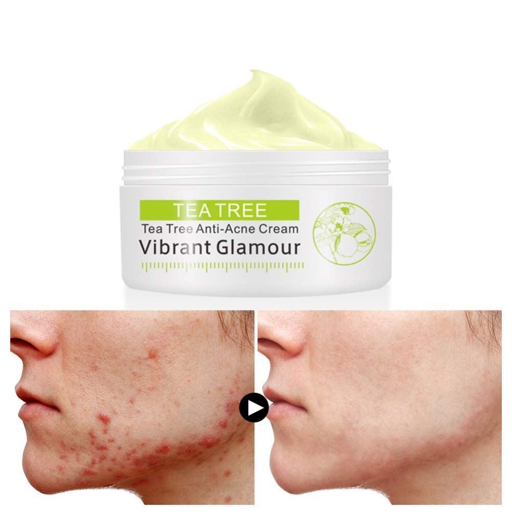 Tea Tree Anti Acne Facial Cream - Pore Minimizer & Blemish Treatment - Oil Control & Pimple Removal - 30g - Perfect for Oily & Acne-Prone Skin - Day & Night Skincare Routine