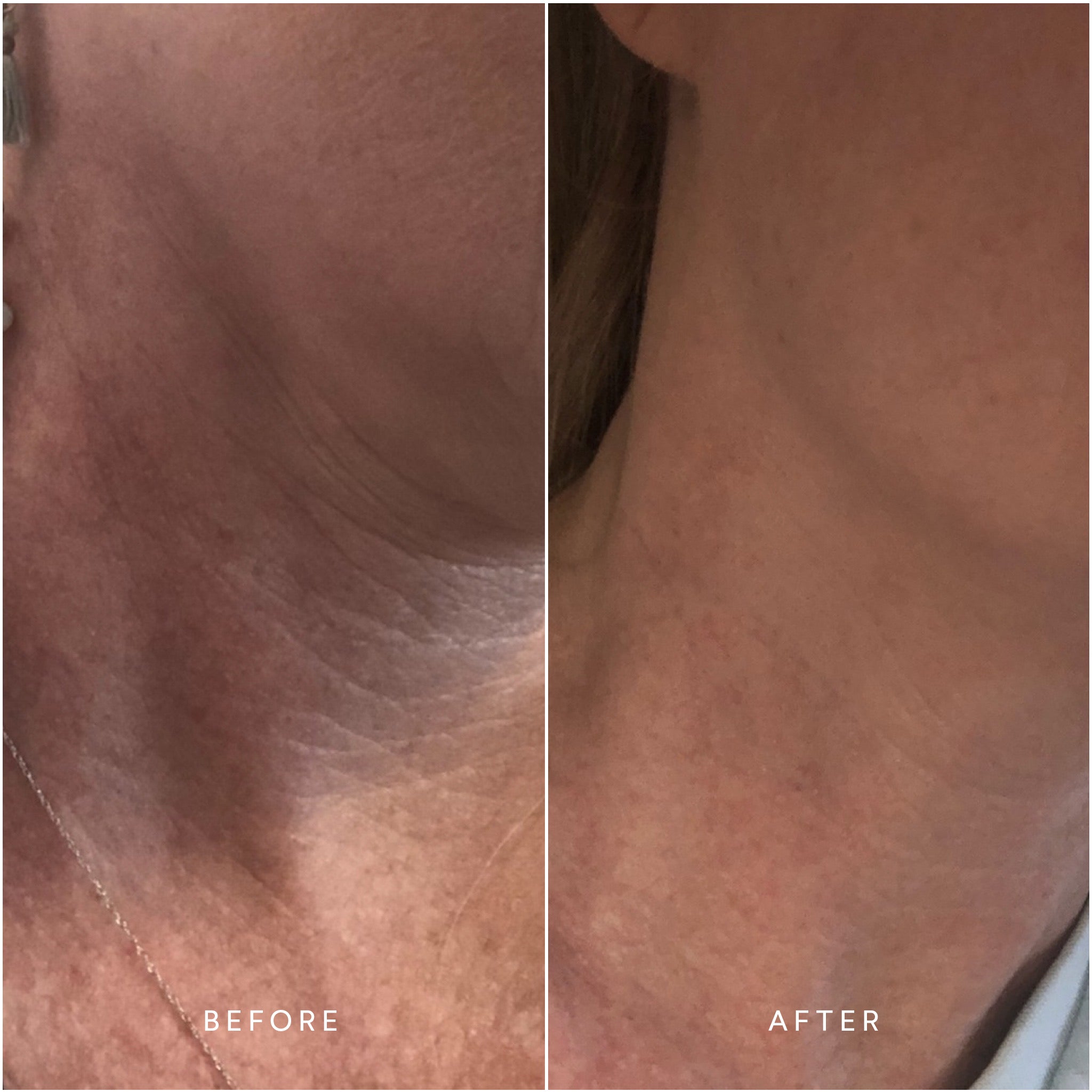 RENEW Repair Nightly Treatment - Anti-Aging Face Cream for Deep Hydration & Skin Repair | Perfect for Nighttime Skincare Routine