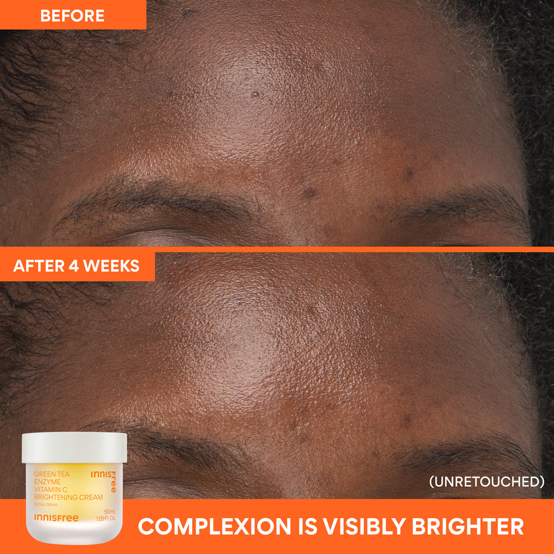 Radiance Routine Skincare Set - Brightening & Hydrating Face Care for Glowing Skin | Perfect for Daily Use & Nighttime Routine