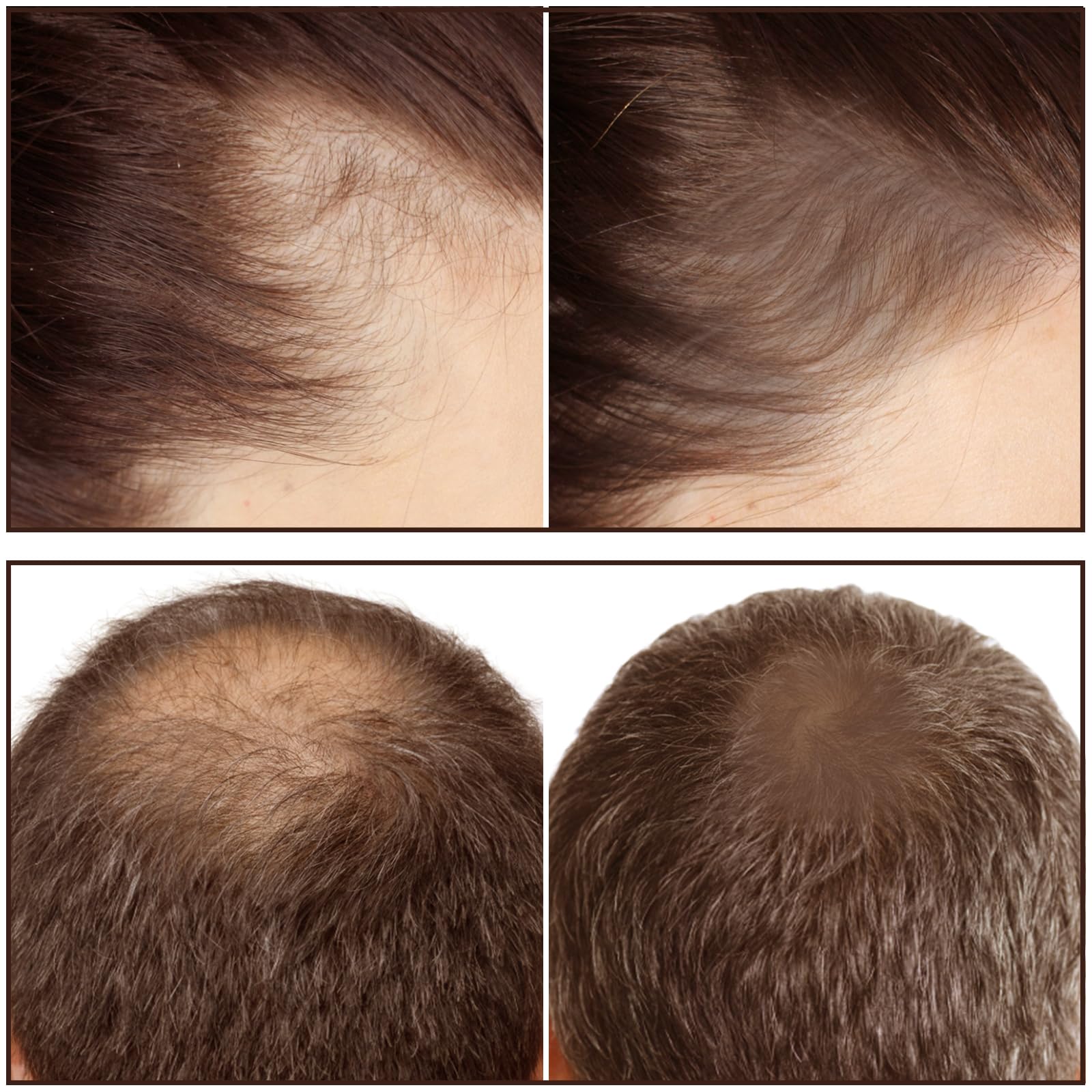 Boobeen Hair Shadow Powder - Instant Hair Root Touch-Up for Thinning Hair & Hair Loss, Natural-Looking Root Concealer - Perfect for Daily Use, Travel & Quick Hairline Fixes