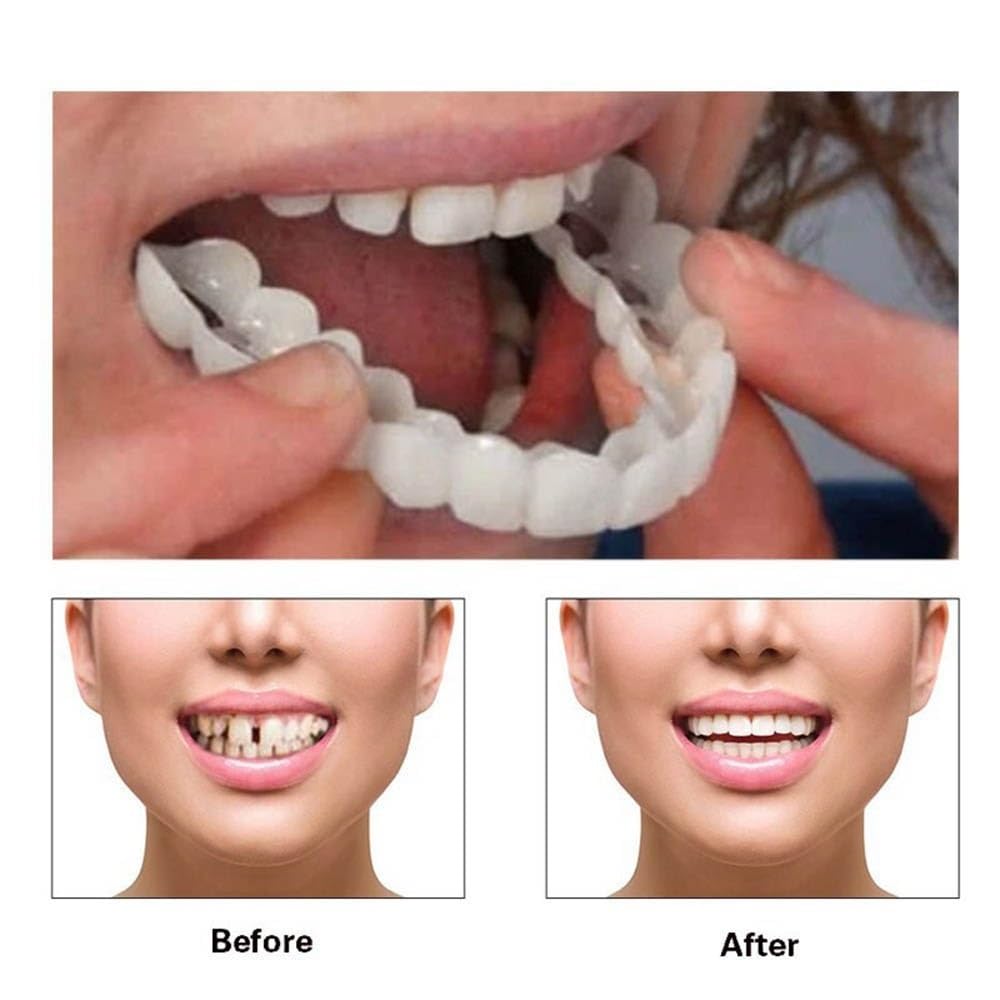 2 Pairs of Temporary Beautiful Smile Veneers - Instant Teeth Whitening & Perfect Smile for Photos, Events & Confidence Boost