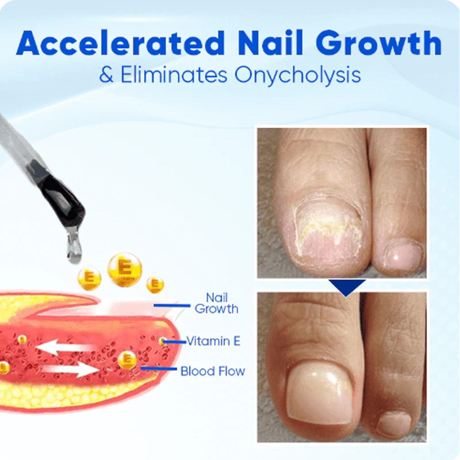 Onyxoguard Nail Growth & Repair Serum - Best Nail Strengthener for Thin & Brittle Nails - Natural Nail Care Treatment with Keratin & Vitamins (2 Pack) - Perfect for Weak, Peeling Nails & Faster Growth at Home or Salon