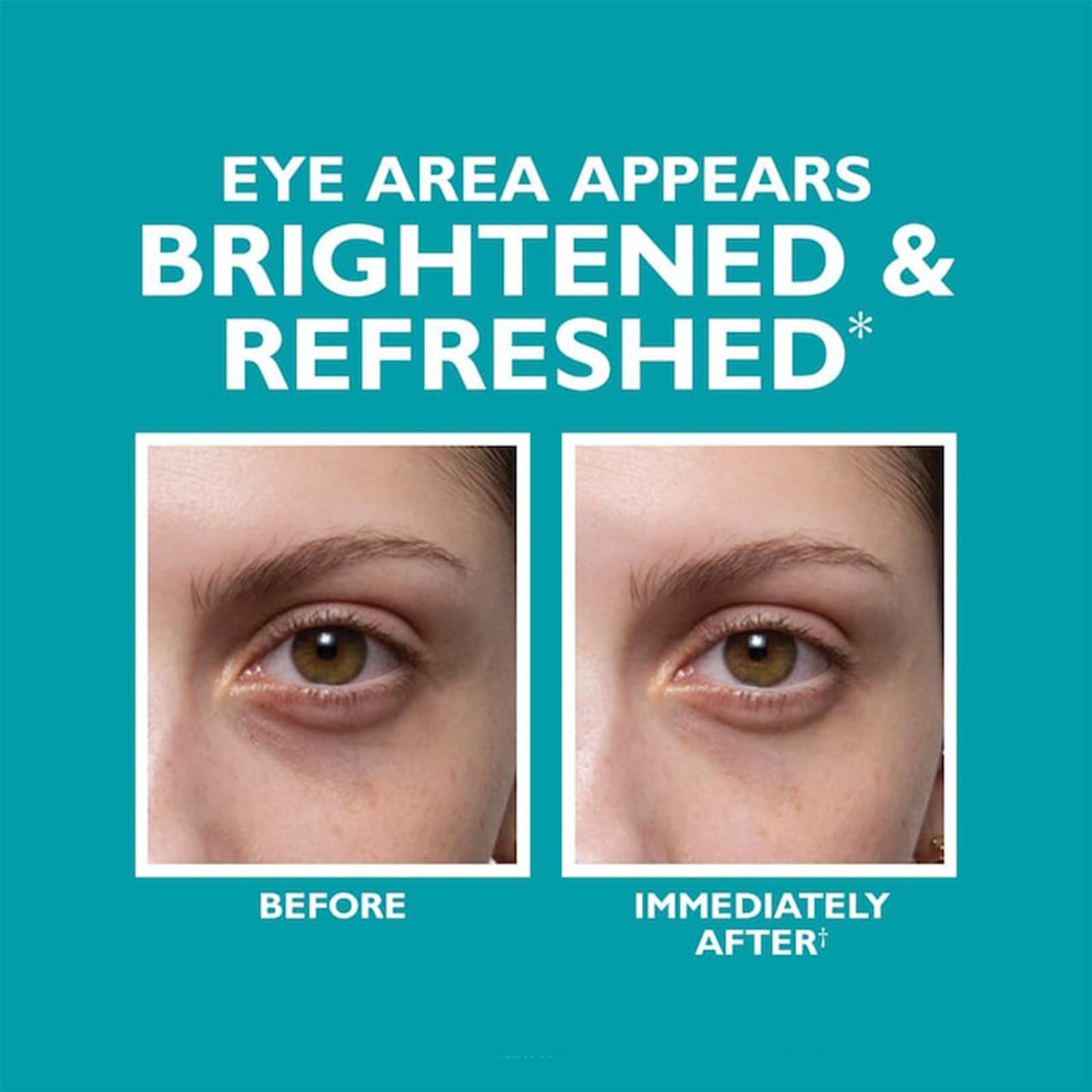 **Peptide Under-Eye Cream for Dark Circles & Wrinkles – Anti-Aging Eye Serum to Reduce Puffiness, Fine Lines & Firm Skin – Fill + Fix Skinjection Treatment (1PC) – Perfect for Nighttime Skincare & Travel**