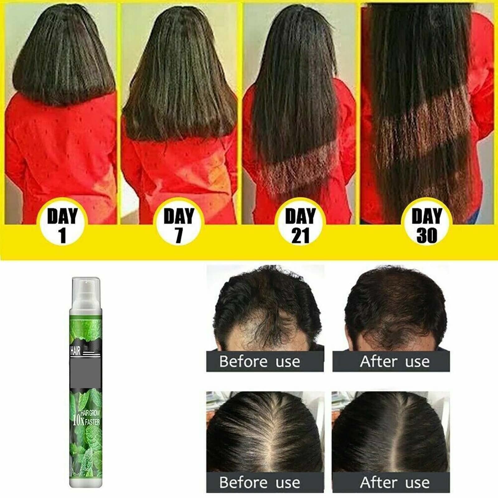 Gokame Hair Growth Serum Spray - Anti Hair Loss, Strengthen & Thicken Hair for Daily Care (2pcs) - Home & Salon Use