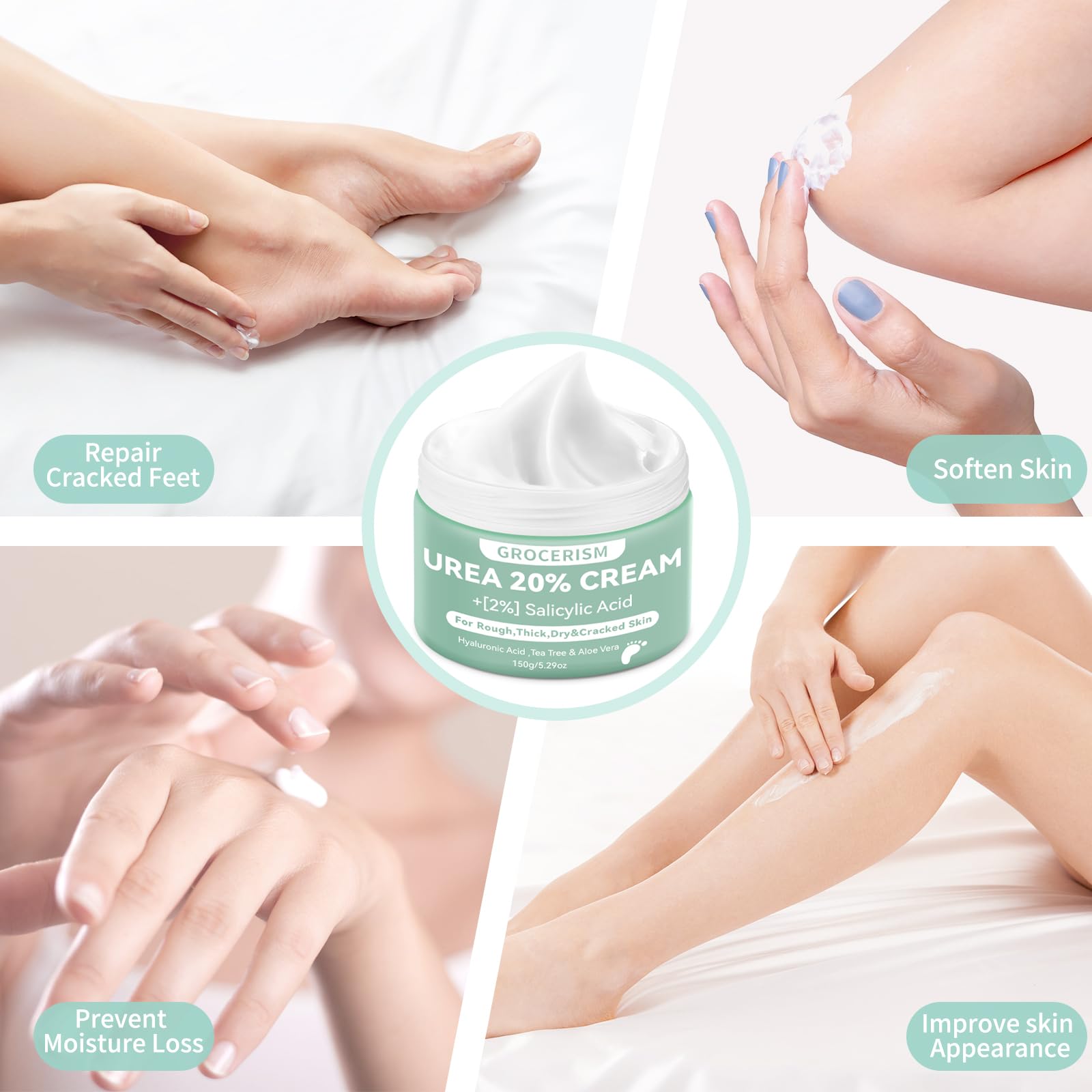 20% Urea Cream with 2% Salicylic Acid - 150g Maximum Strength Foot & Hand Moisturizer - Infused with Hyaluronic Acid, Tea Tree & Aloe Vera for Deep Hydration | Cracked Heel Treatment, Dry Skin Relief for Calluses & Rough Feet