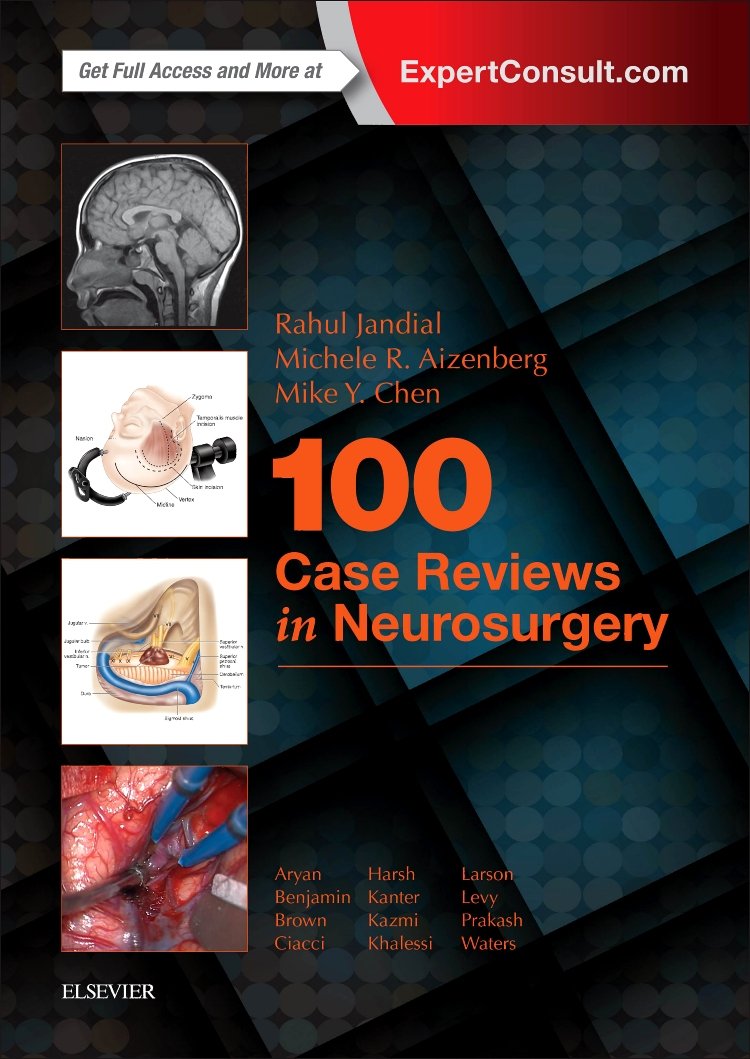 100 Neurosurgery Case Reviews - Comprehensive Guide for Medical Professionals & Students | Perfect for Study, Research & Clinical Practice