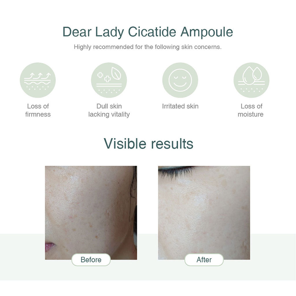 Dermamular Dear Lady Cicatide Ampoule 30ml - Skin Repair Serum for Scars & Wrinkles - Perfect for Post-Surgery Care & Anti-Aging Routine