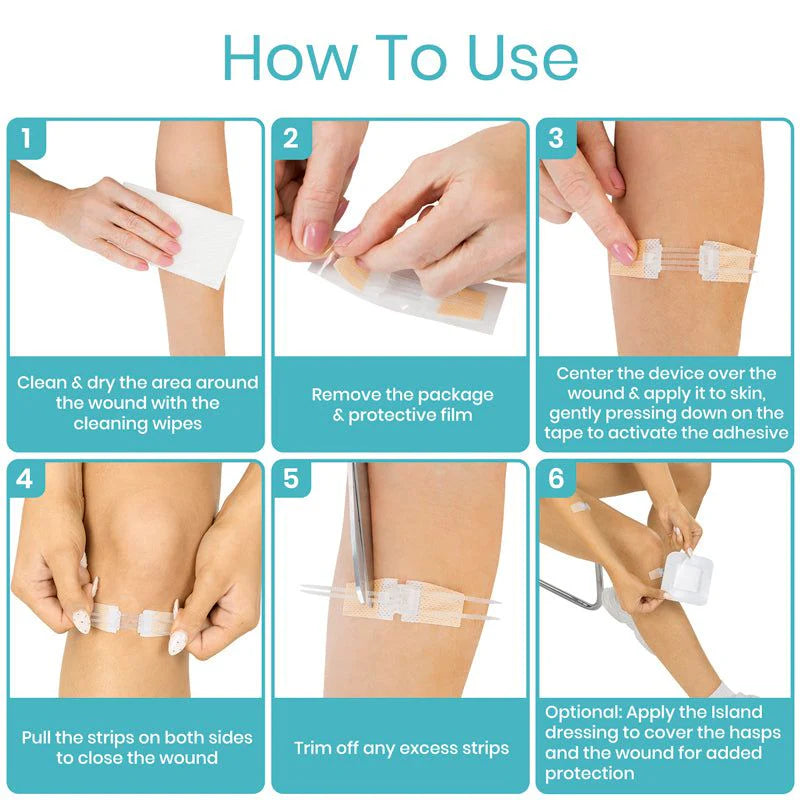 Vive Wound Closure Kit - Sterile Medical Suture Kit for First Aid, Emergency & Surgical Use - Perfect for Hospitals, Clinics & Home First Aid Kits