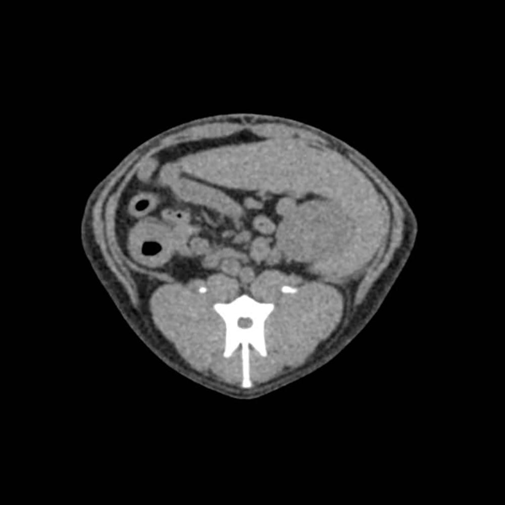Dog Abdomen Phantom for CT Scan and X-Ray Training - Veterinary Radiology Practice, Medical Education, and Diagnostic Imaging Simulation