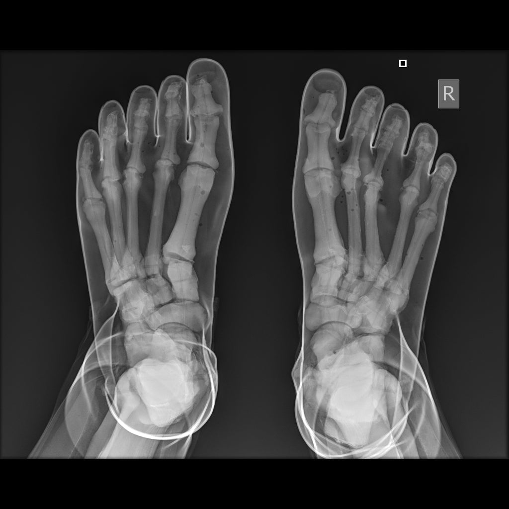 Full Body X-Ray and Radiographic Positioning Manikin - Professional Medical Training Model for Radiology Students & Technicians - Perfect for Classroom, Lab & Clinical Practice