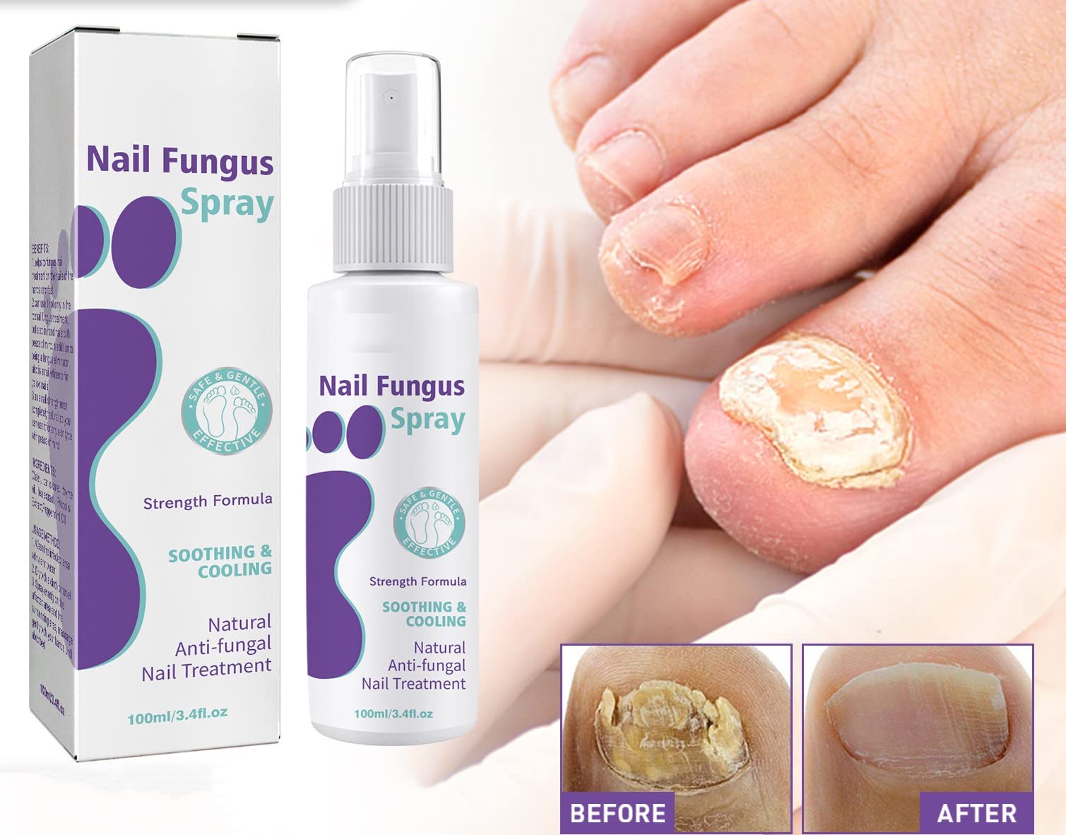 Nail Repair Essence & Treatment - Maximum Strength Nail Solution for Discolored & Damaged Nails - Restores & Strengthens Nails Fast - Perfect for Manicures, Pedicures & Nail Care Routines